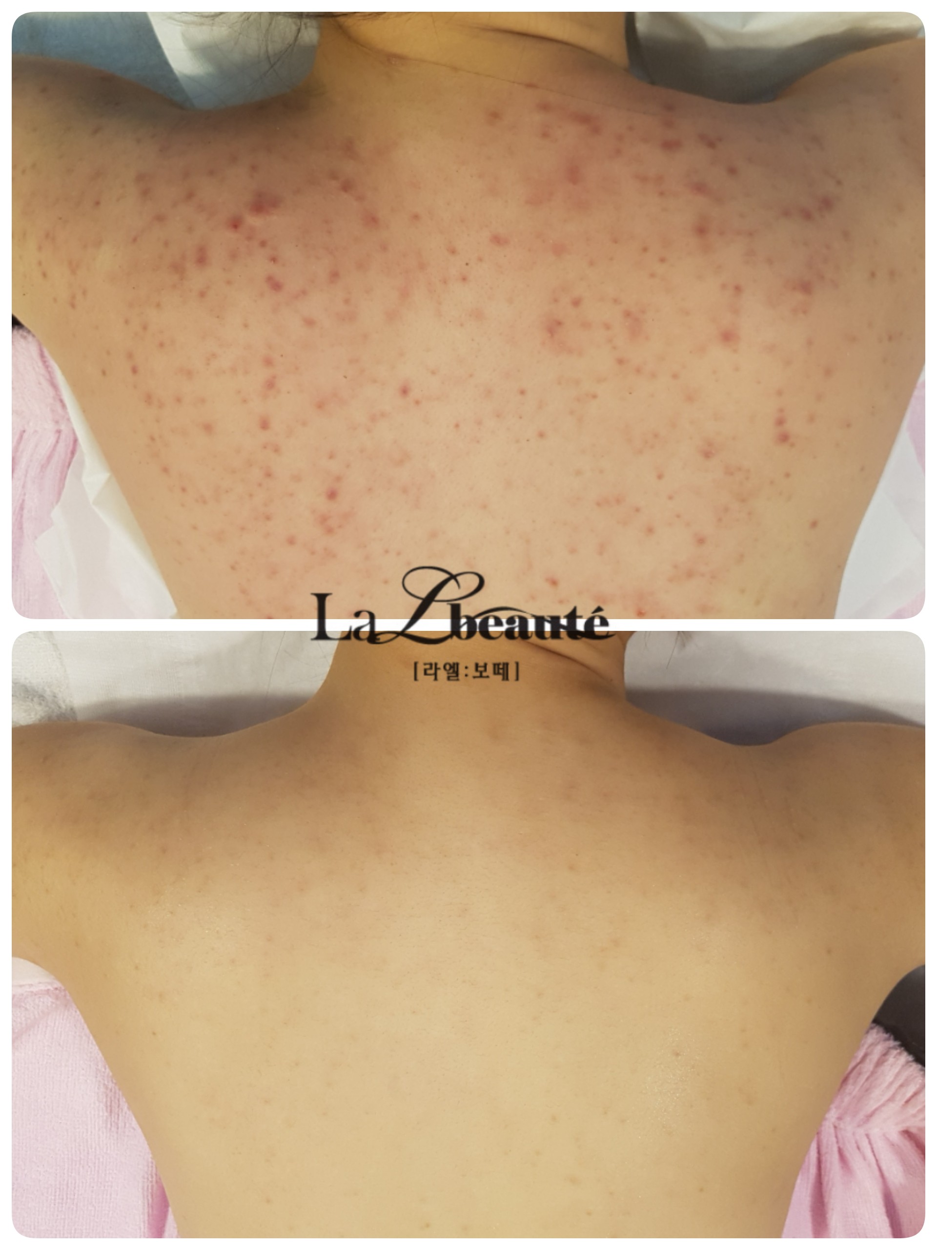 라엘보떼 대표 이미지