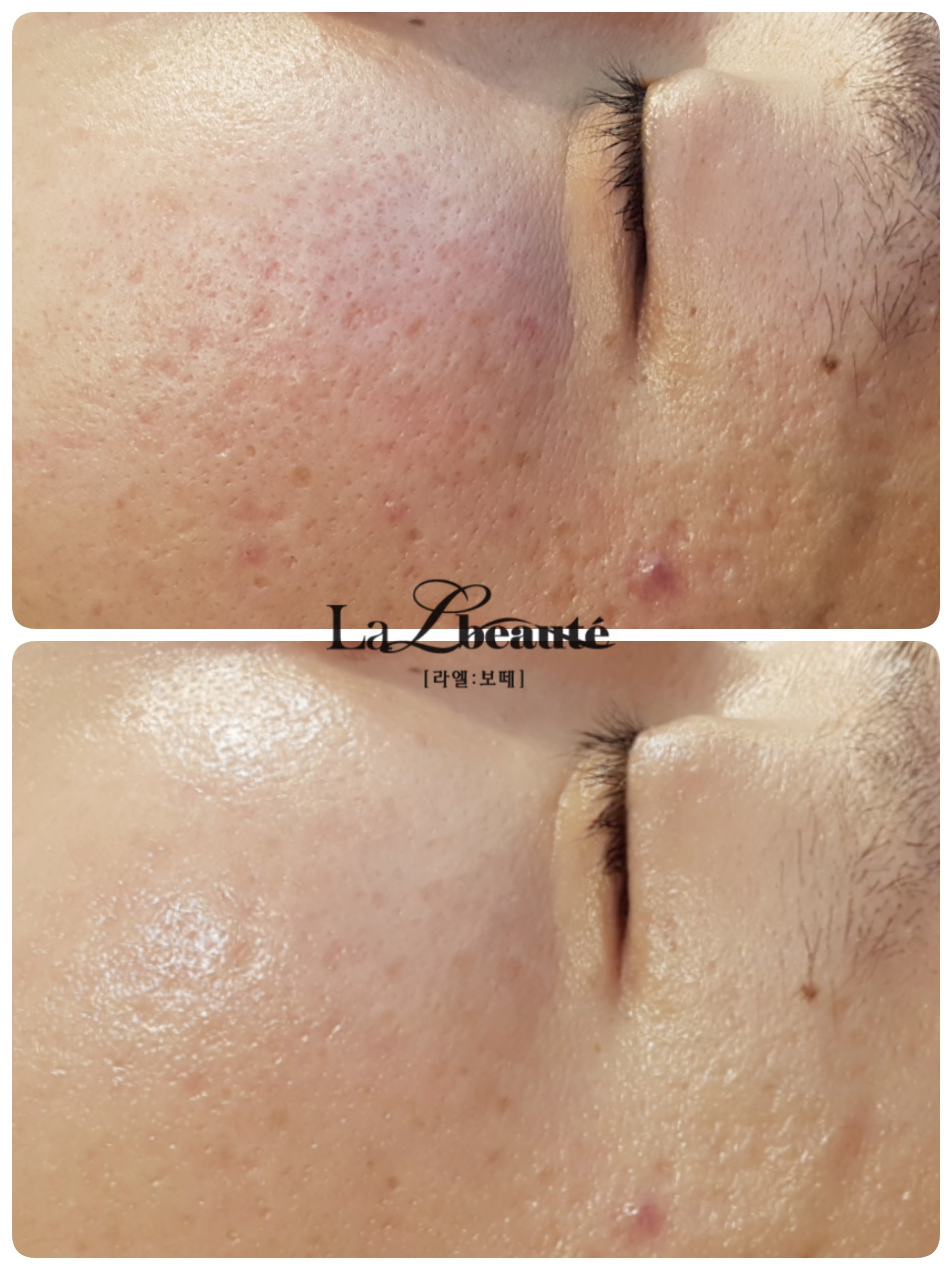 라엘보떼 대표 이미지