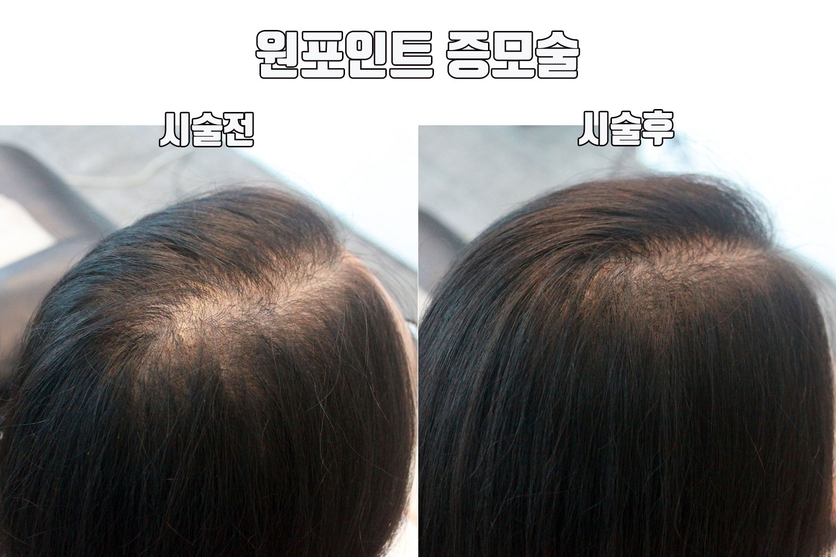 머리에 반하다