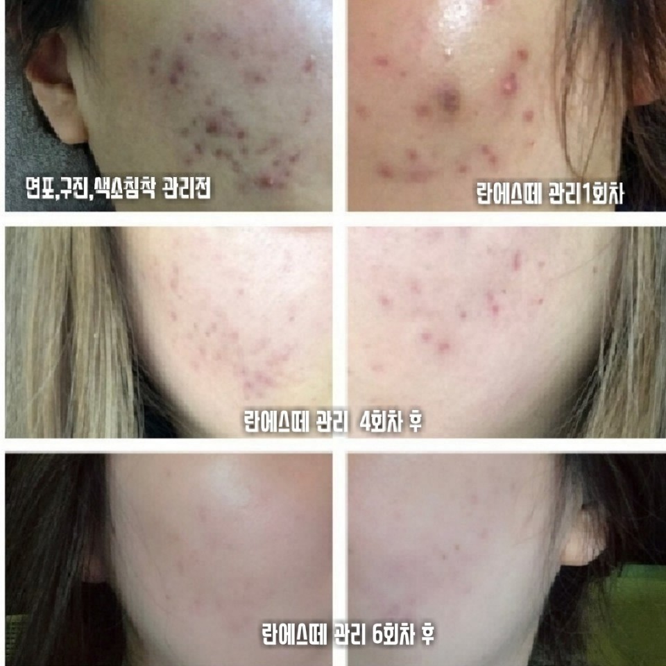 란에스떼 대표 이미지