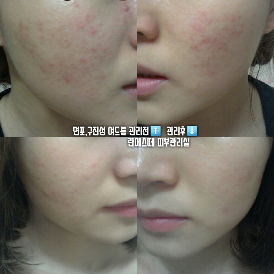 란에스떼 대표 이미지