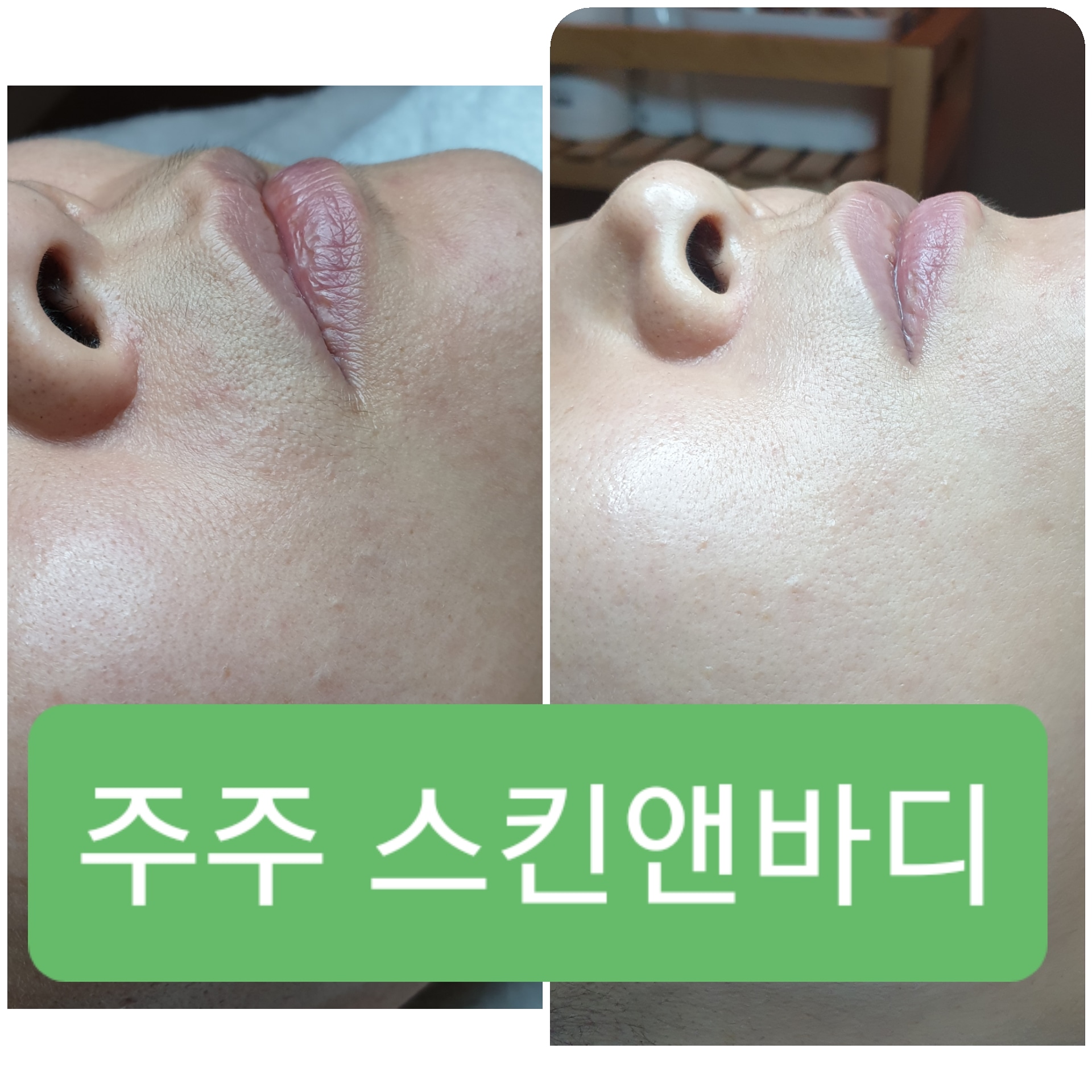 주주스킨앤바디