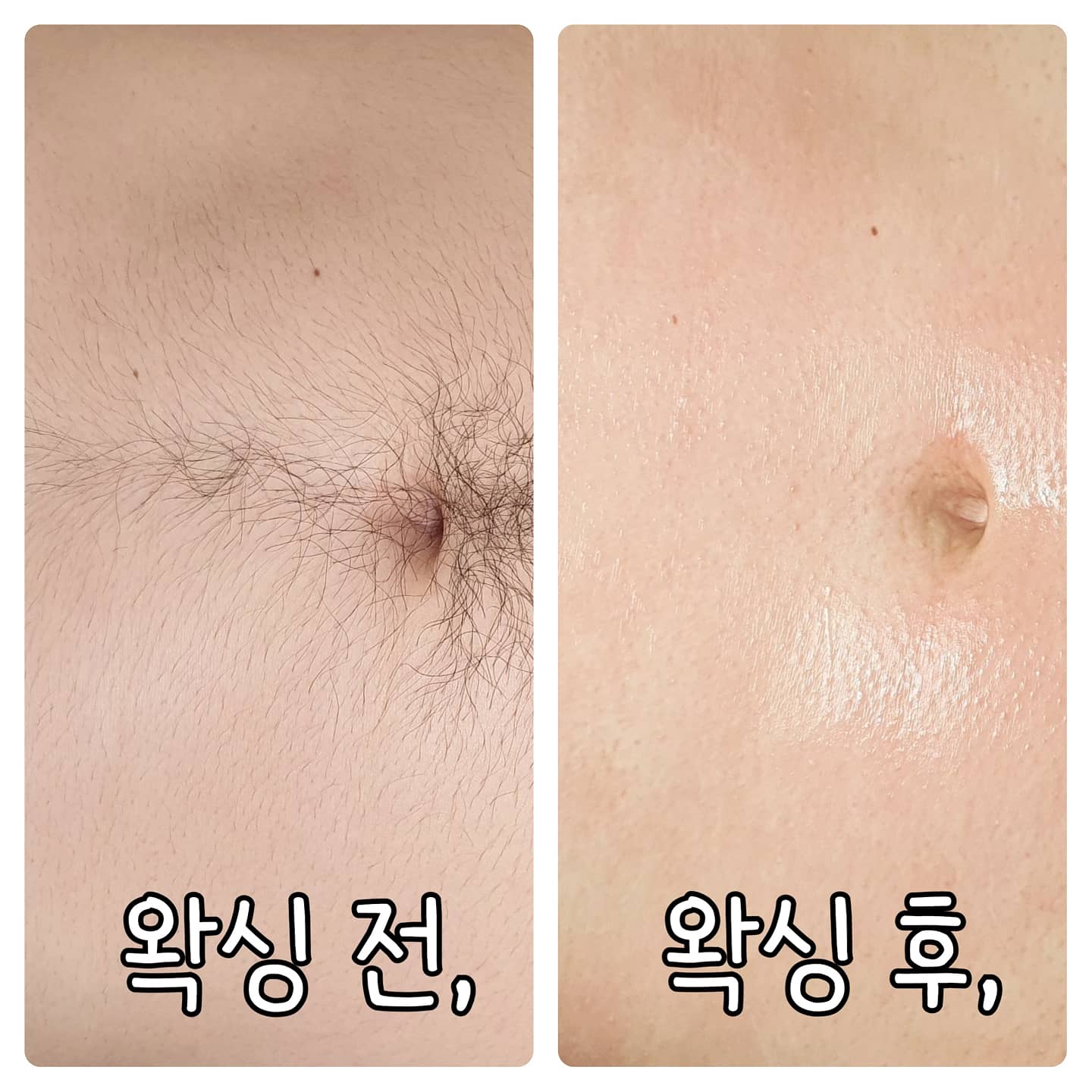 뽑고왁싱 대표 이미지