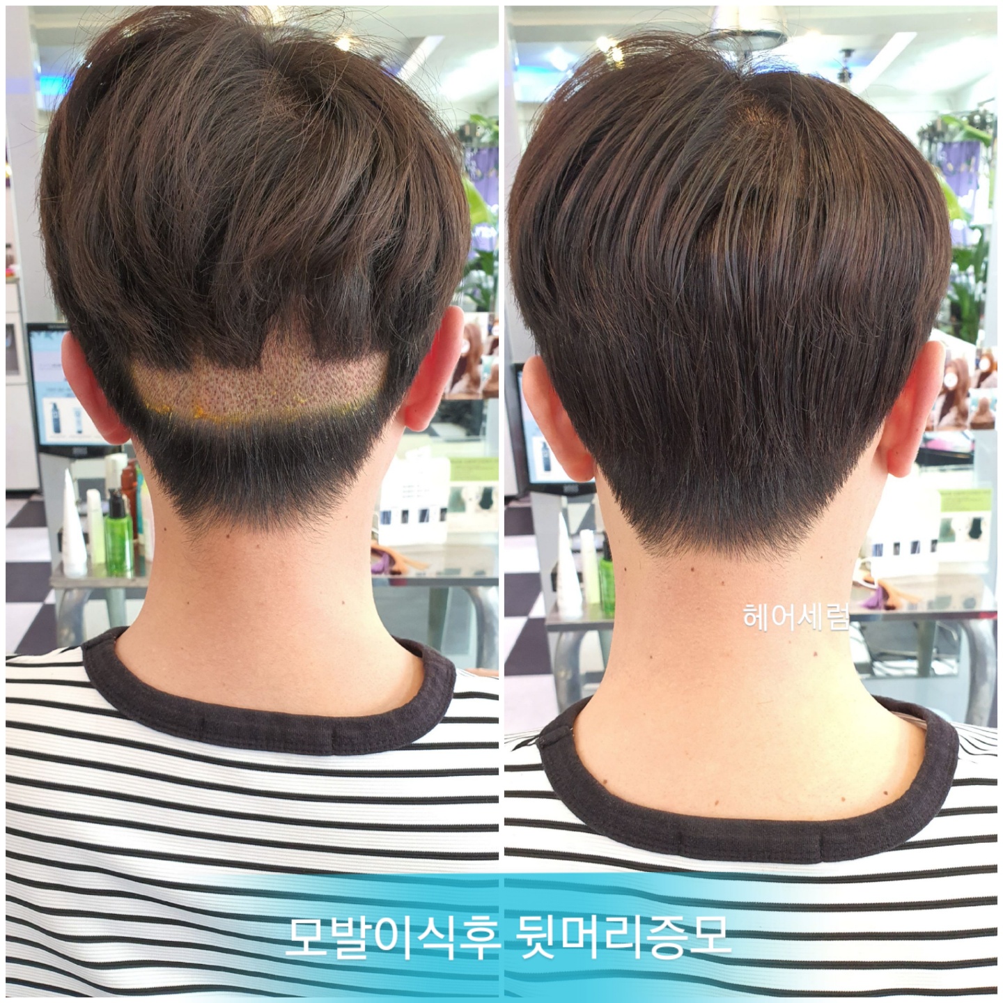 붙임머리 헤어세럼 대표 이미지