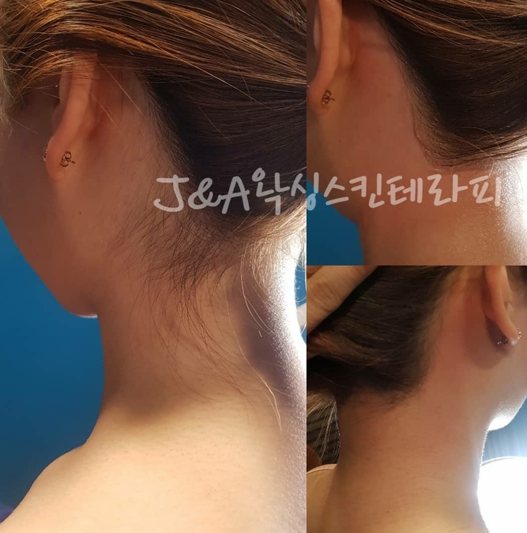 제이엔에이 왁싱 스킨 테라피