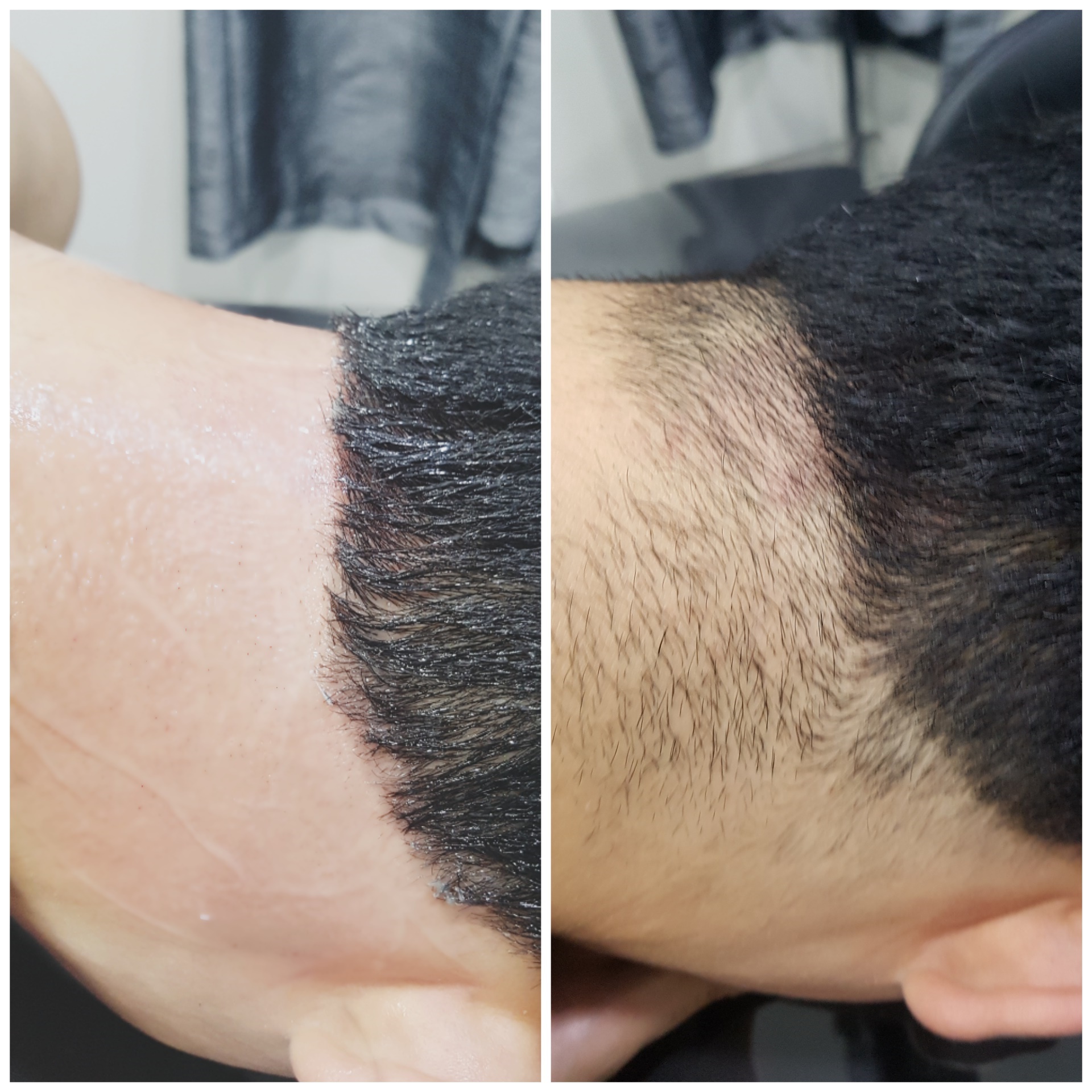 대구왁싱 글램뷰티 브라질리언왁싱 동성로 반월당 남자눈썹