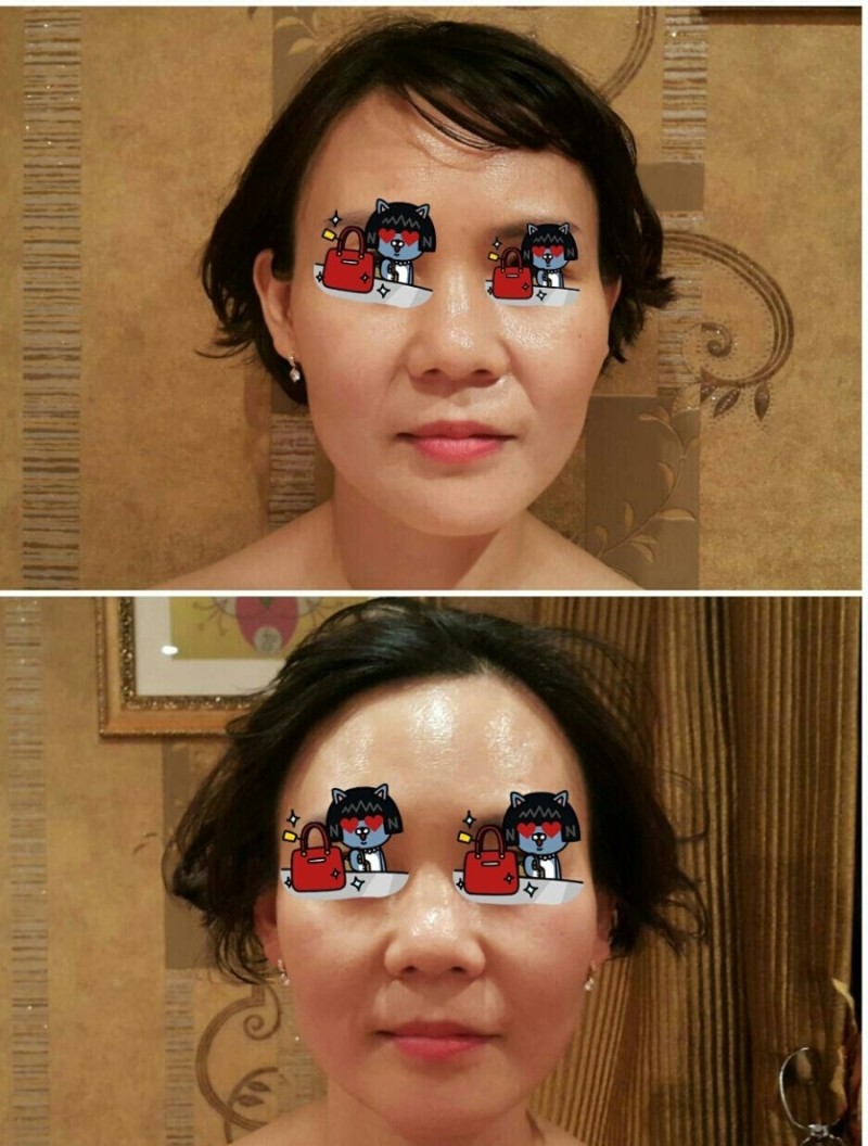 구해진피부사랑
