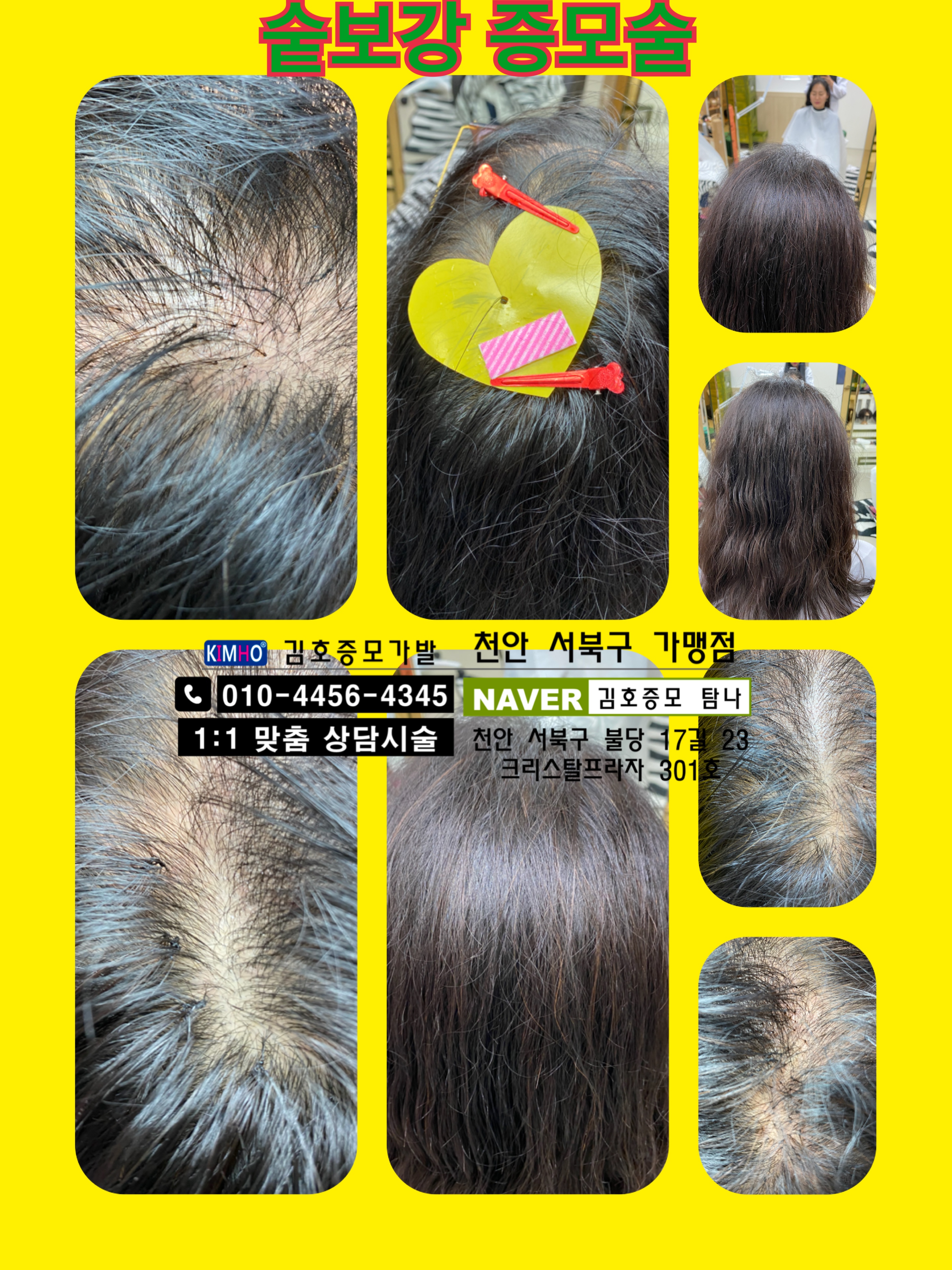 김호증모가발 탐나
