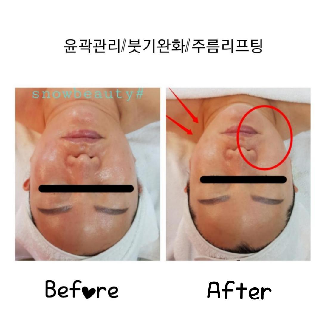 스노우뷰티 대표 이미지