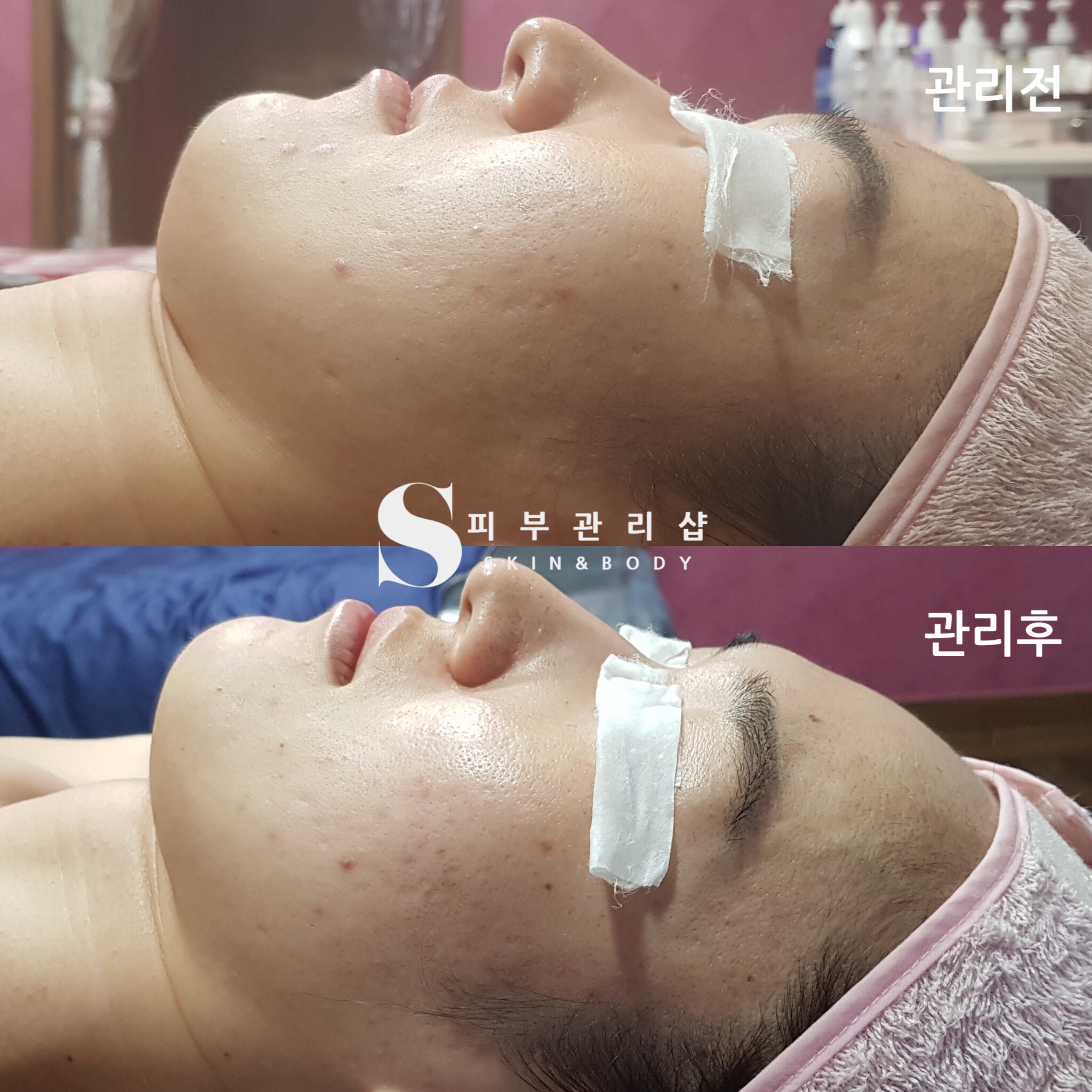 S피부관리샵