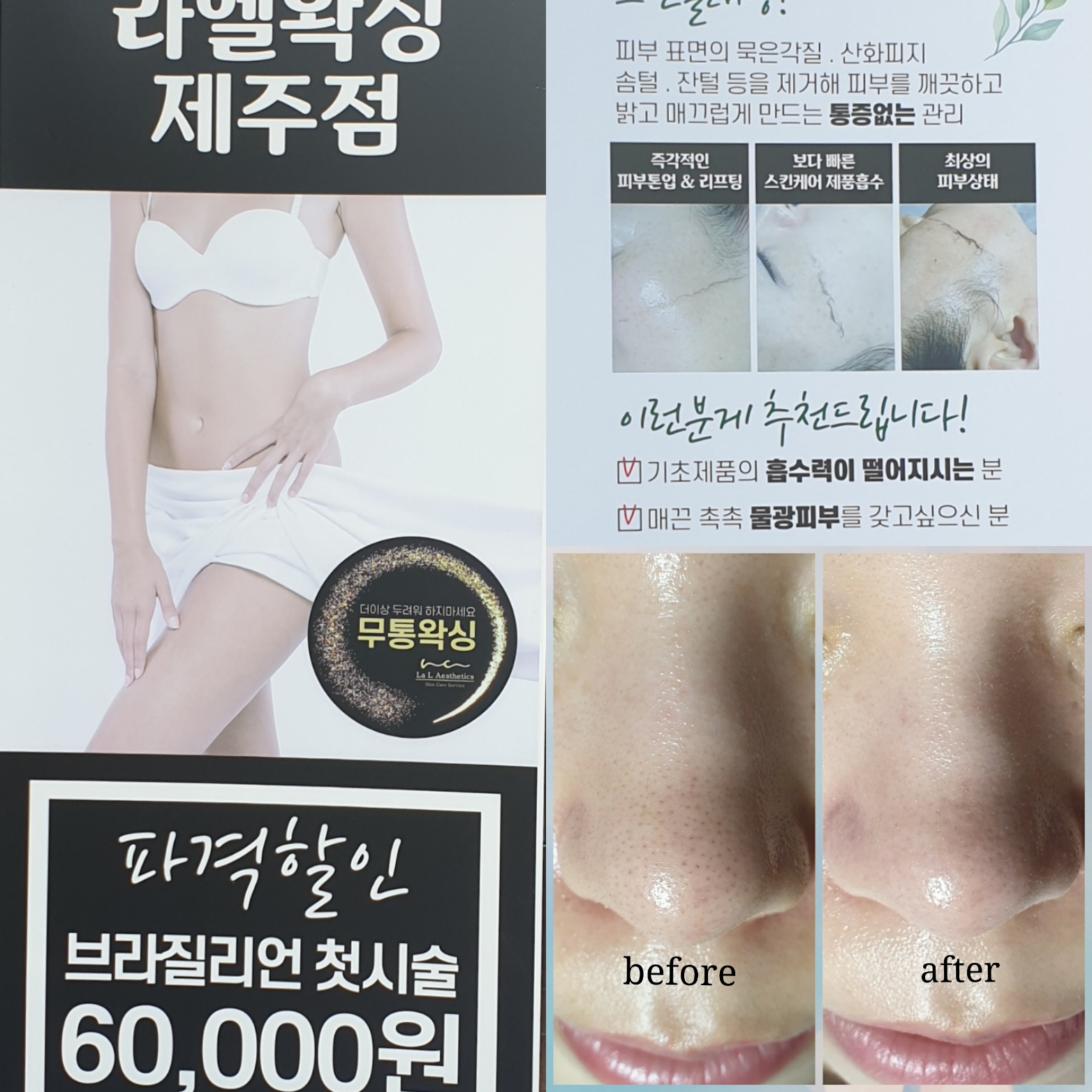 더미모 라엘왁싱