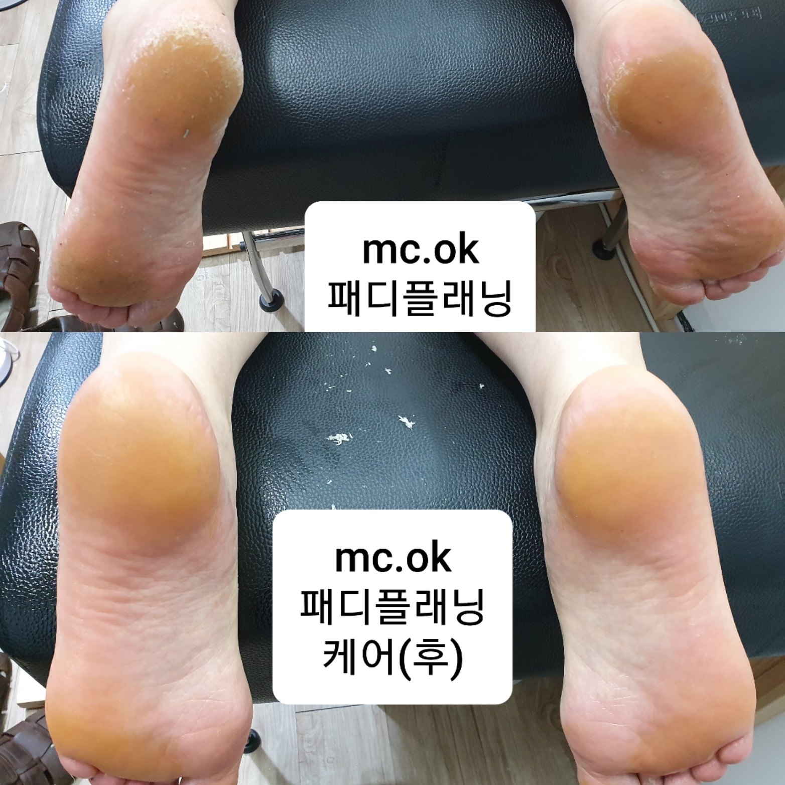 에이오제이