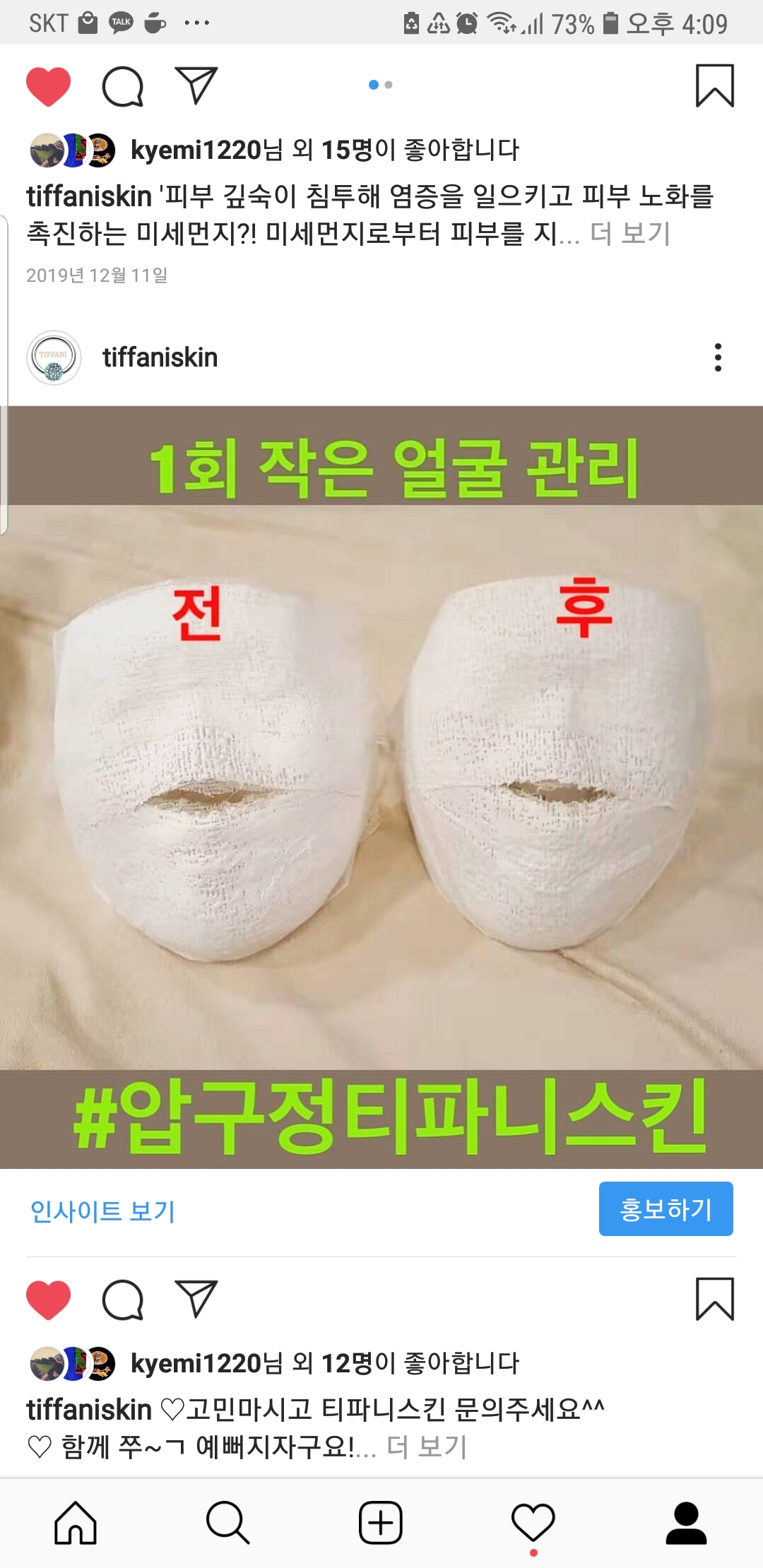 티파니스킨