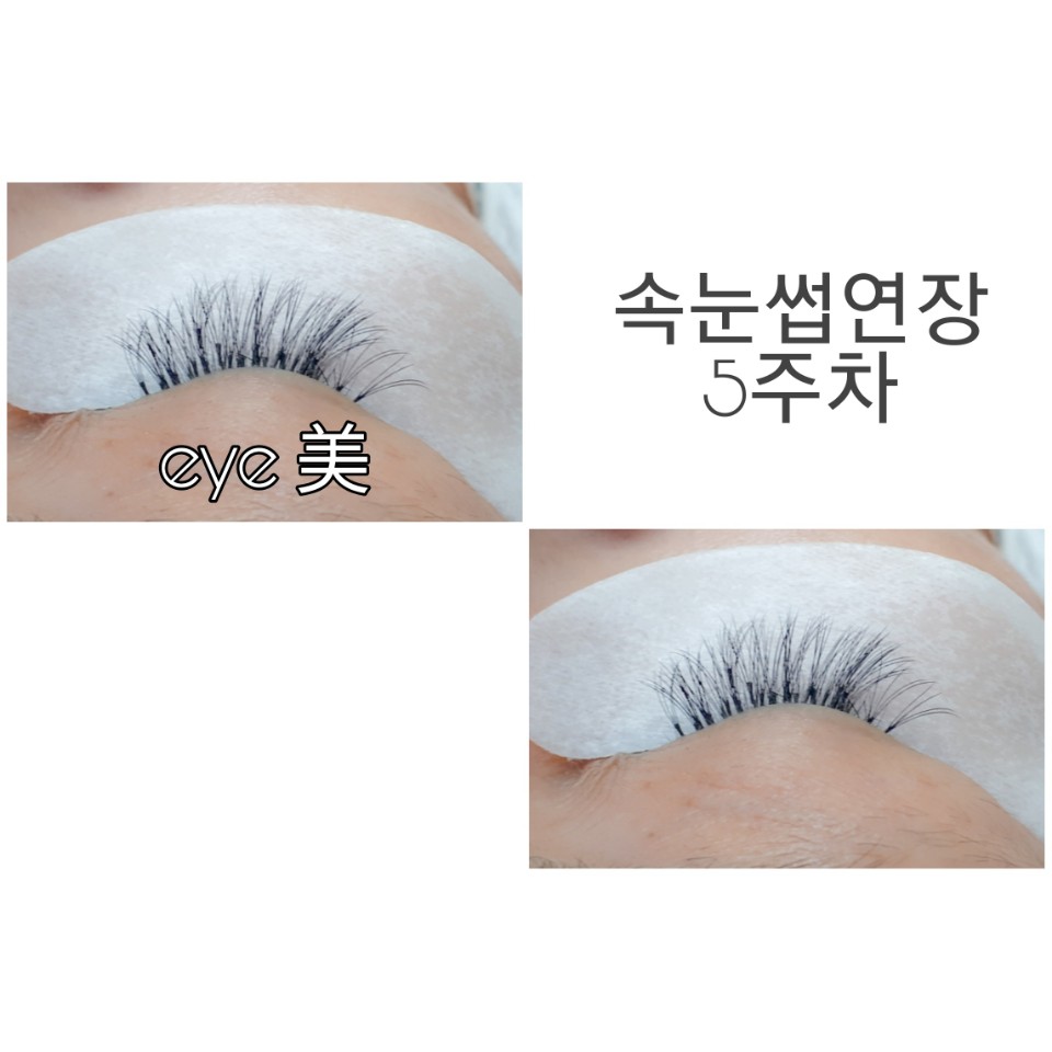 아이미 대표 이미지