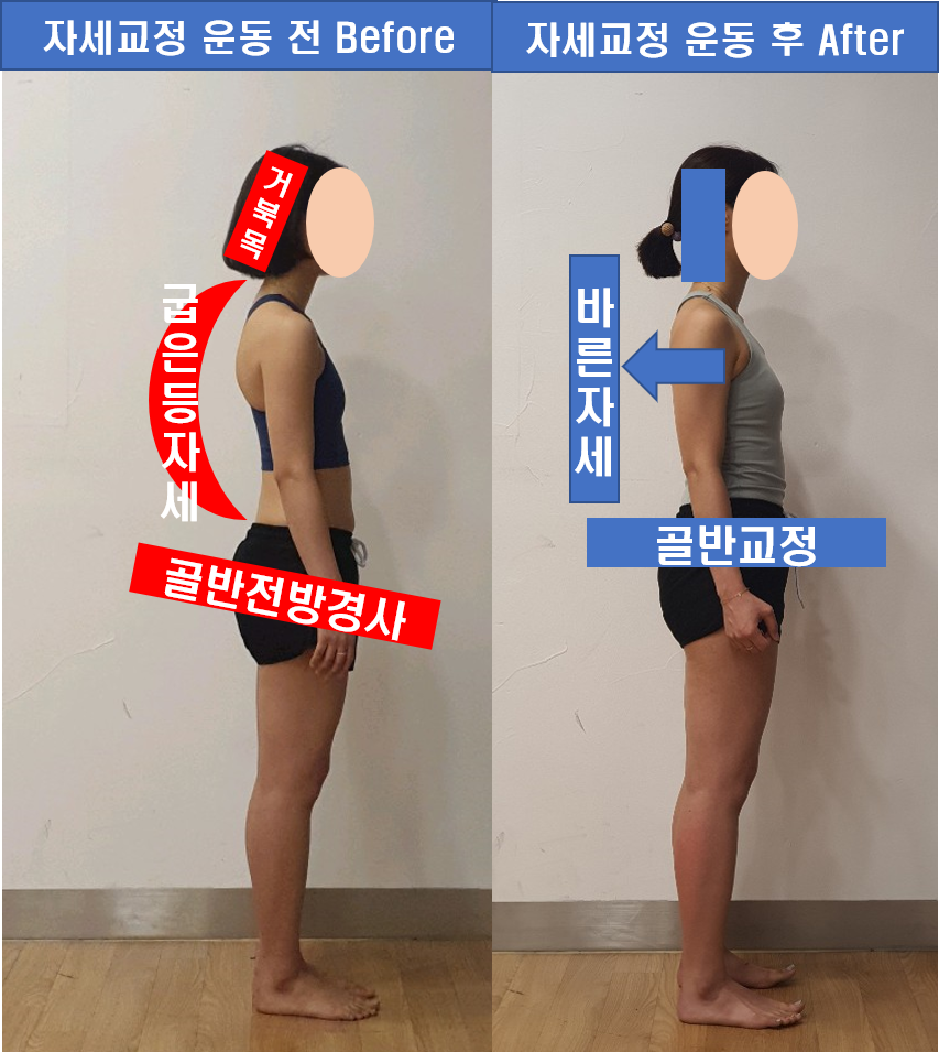 바른자세 바른운동센터
