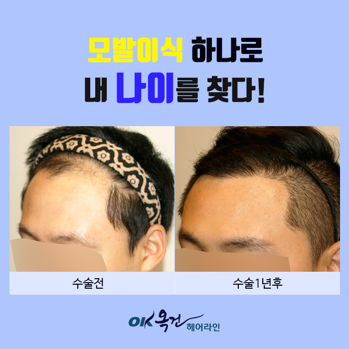 옥건헤어라인의원 대표 이미지