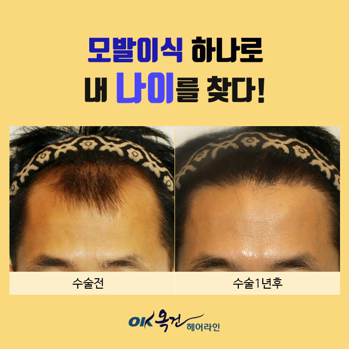 옥건헤어라인의원 대표 이미지