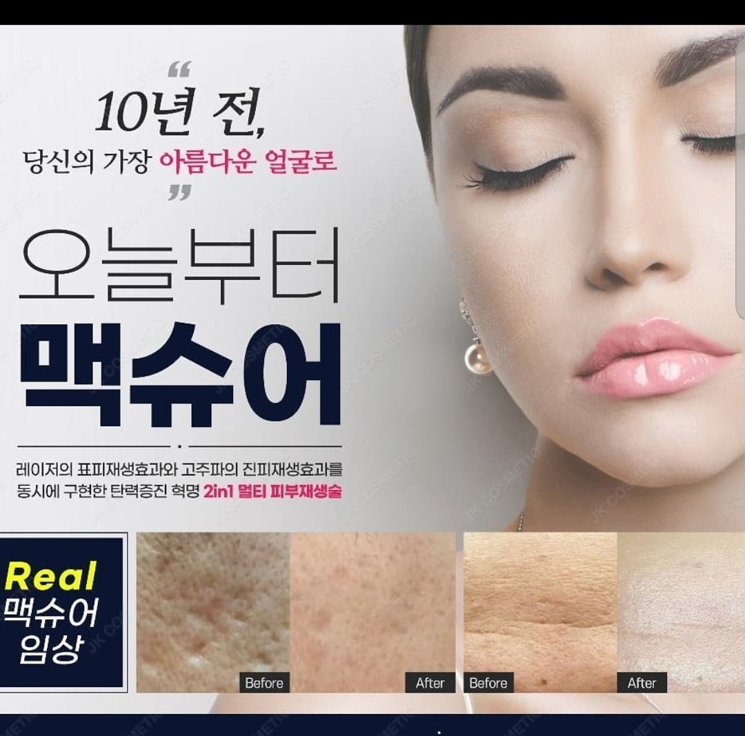 콜드플라즈마지사 아미뷰티 아카데미