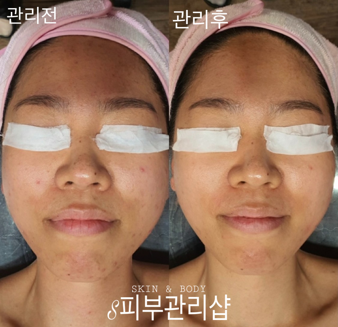 S피부관리샵