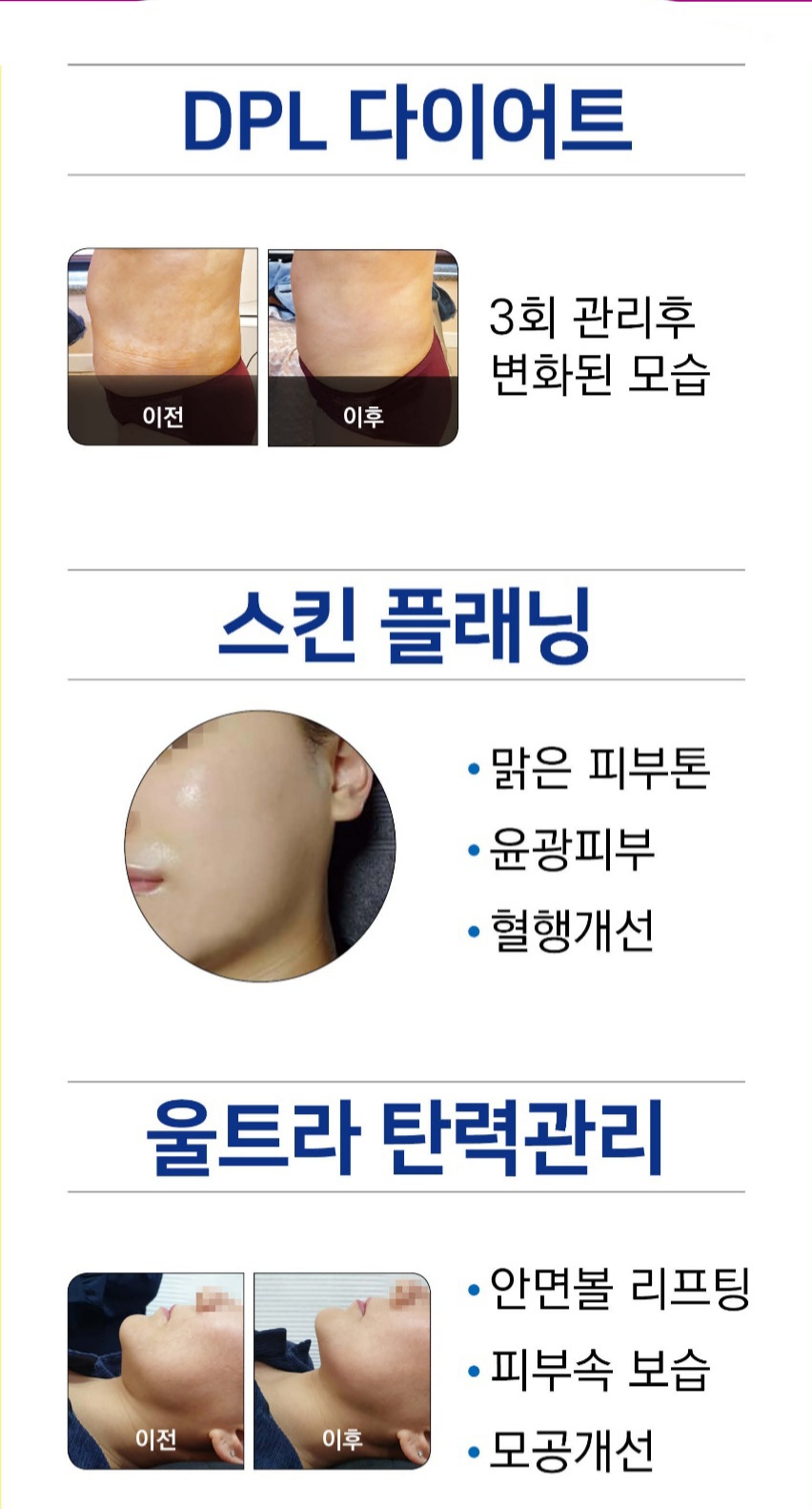 채움에스테틱