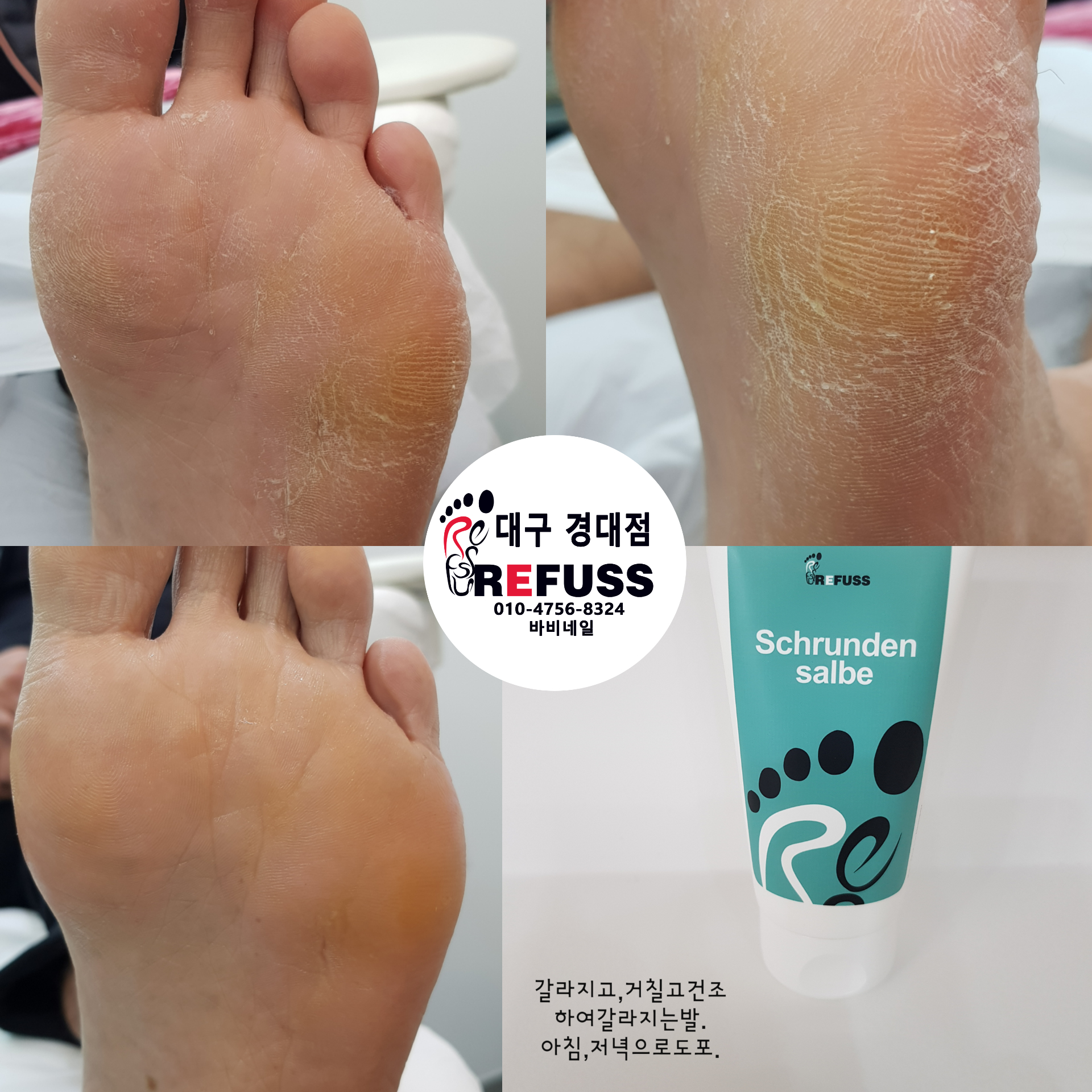 레푸스 경대점