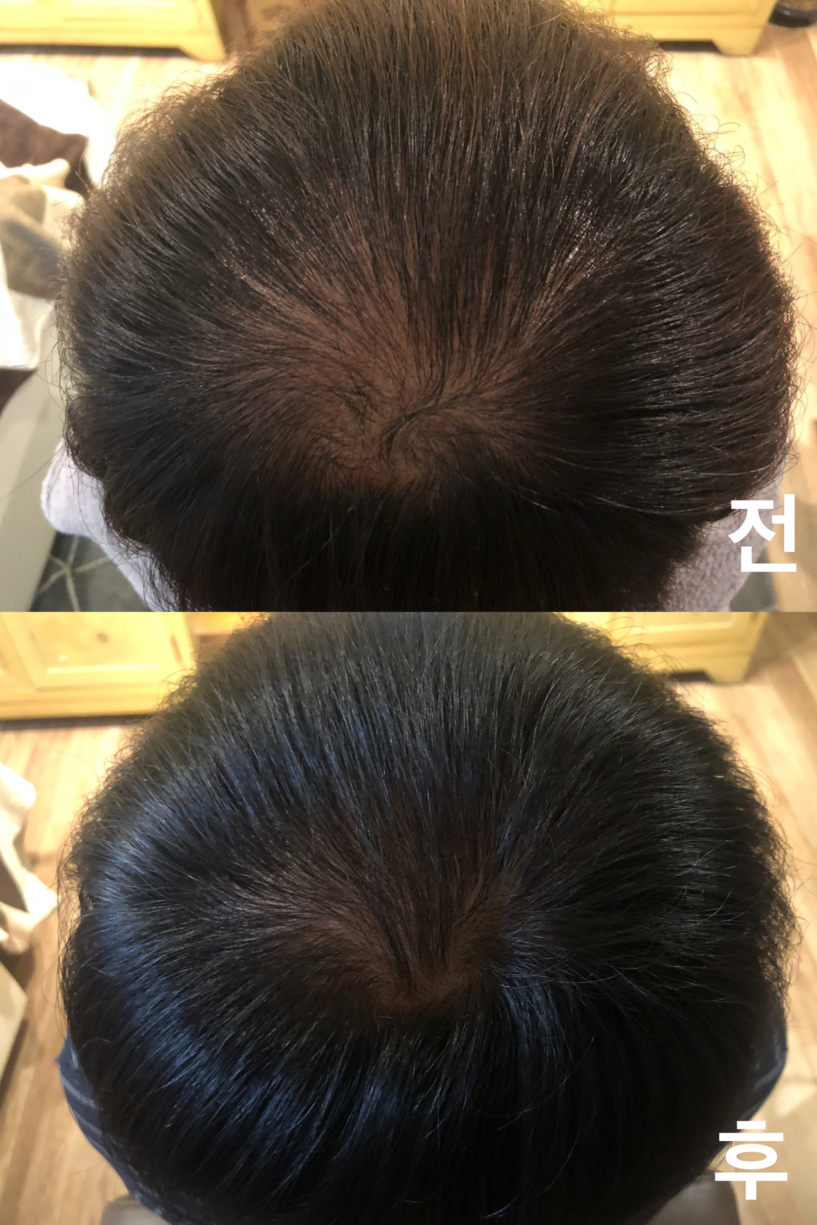 탈모의해답 구미점 대표 이미지