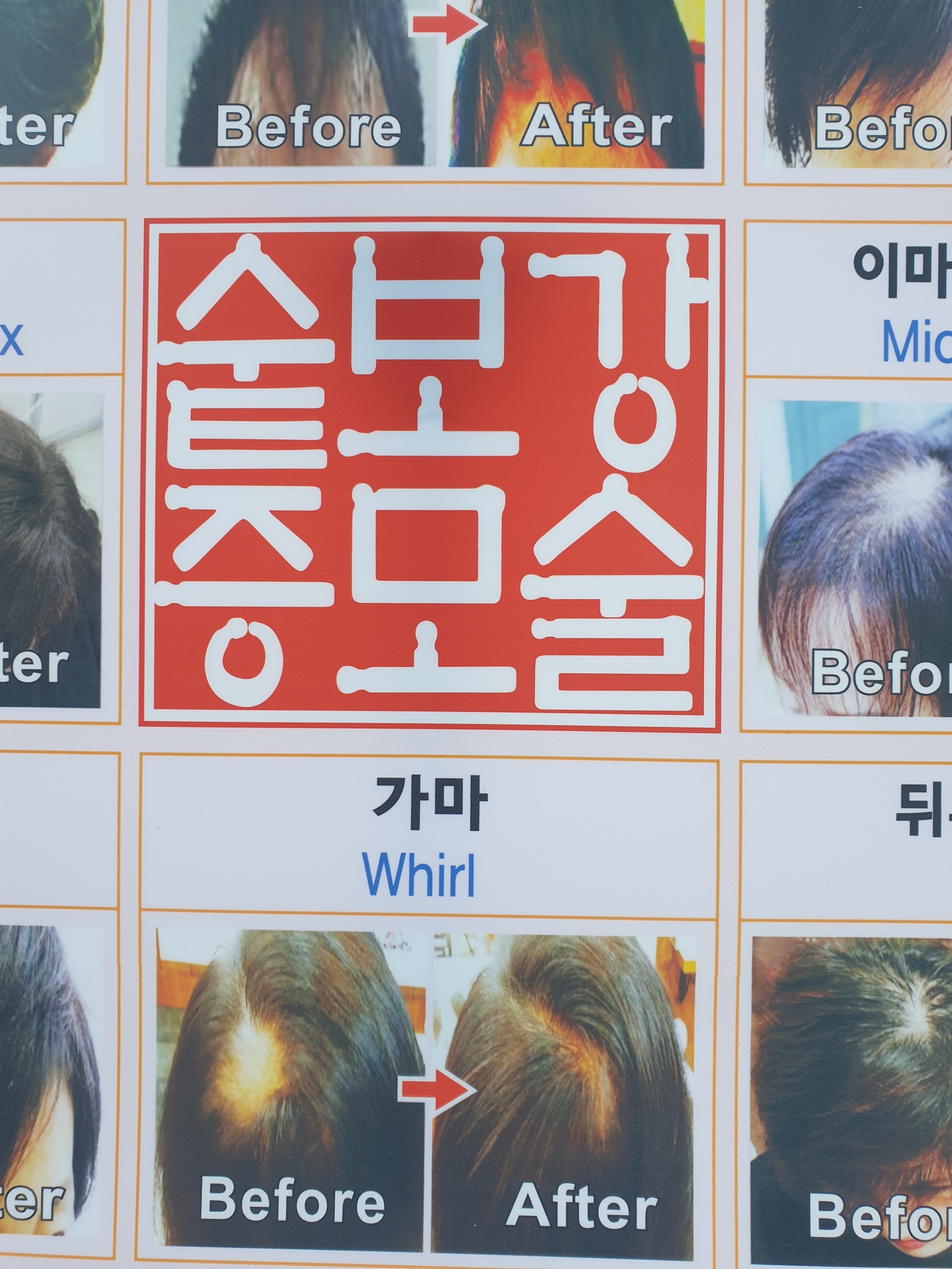 김호증모가발샵 네츄럴헤어