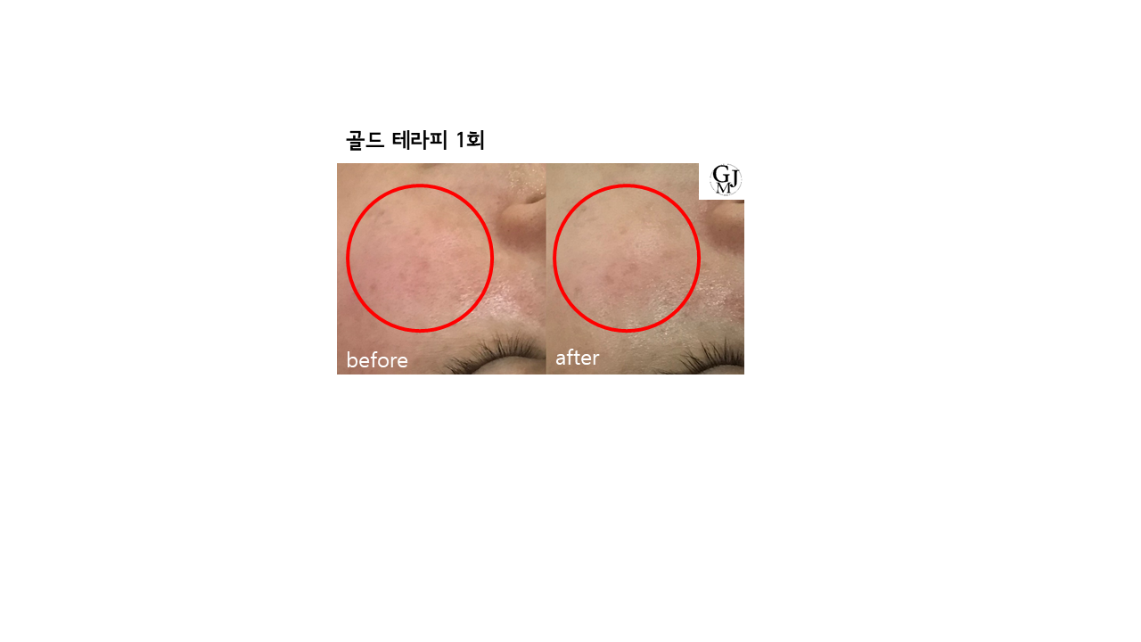 고민정피부관리실