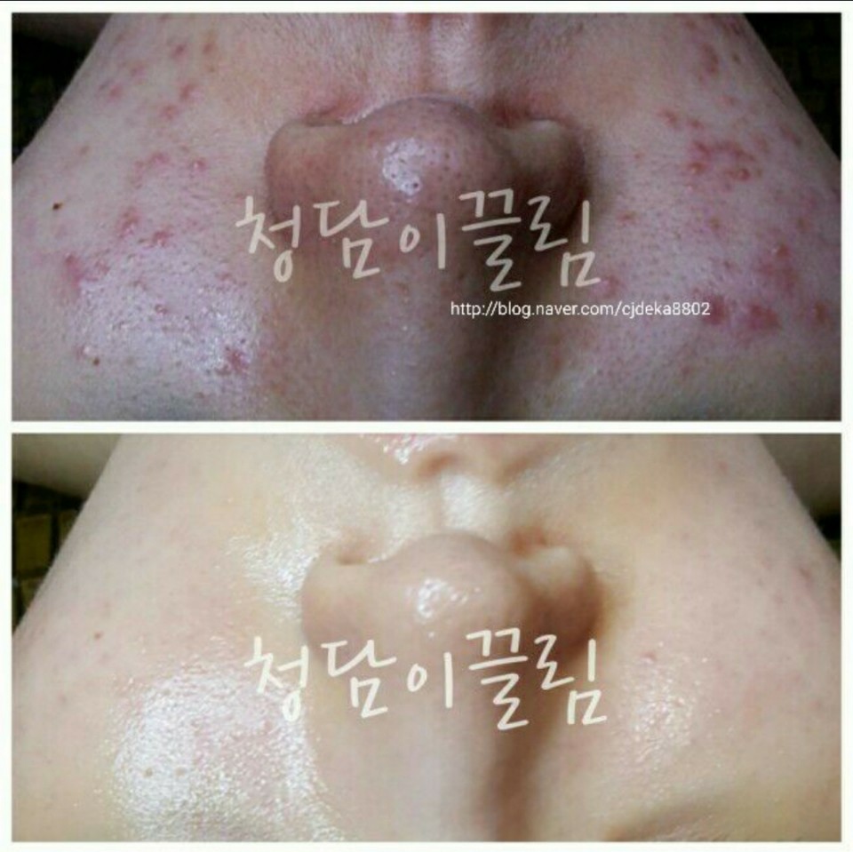 청담이끌림 photo 6