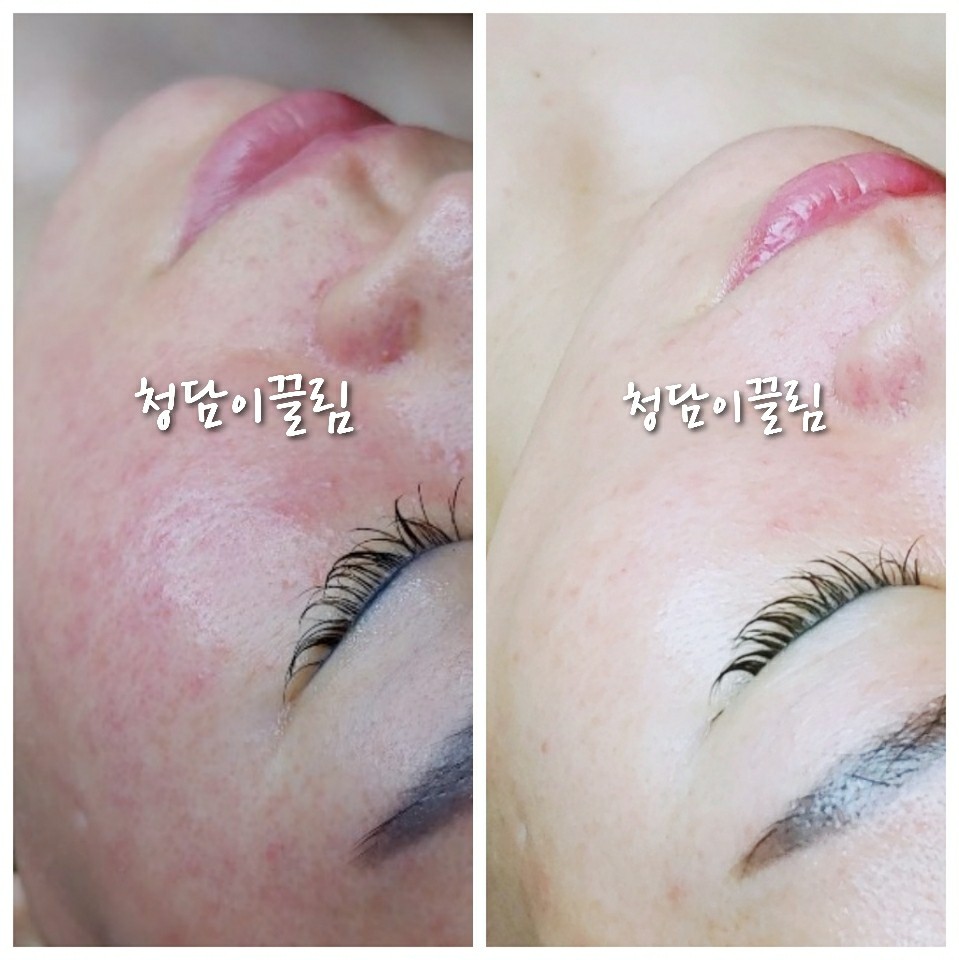 청담이끌림 photo 5