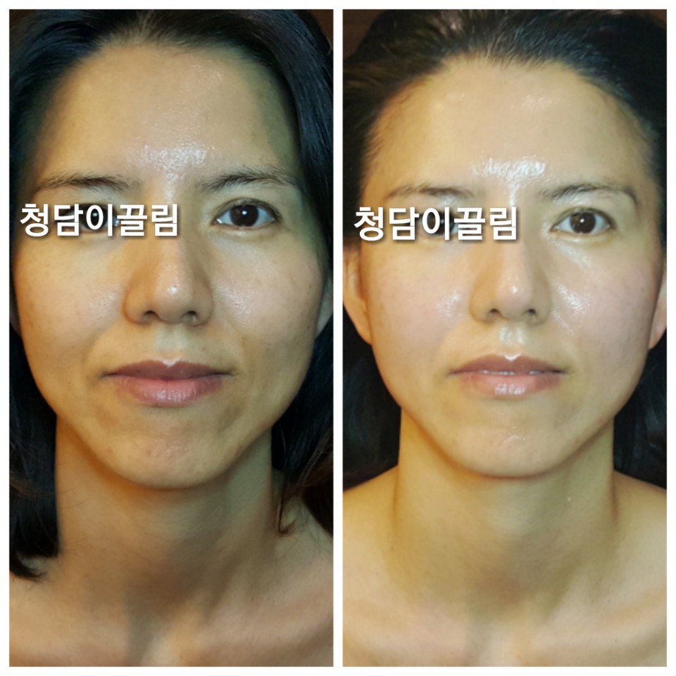 청담이끌림 photo 4
