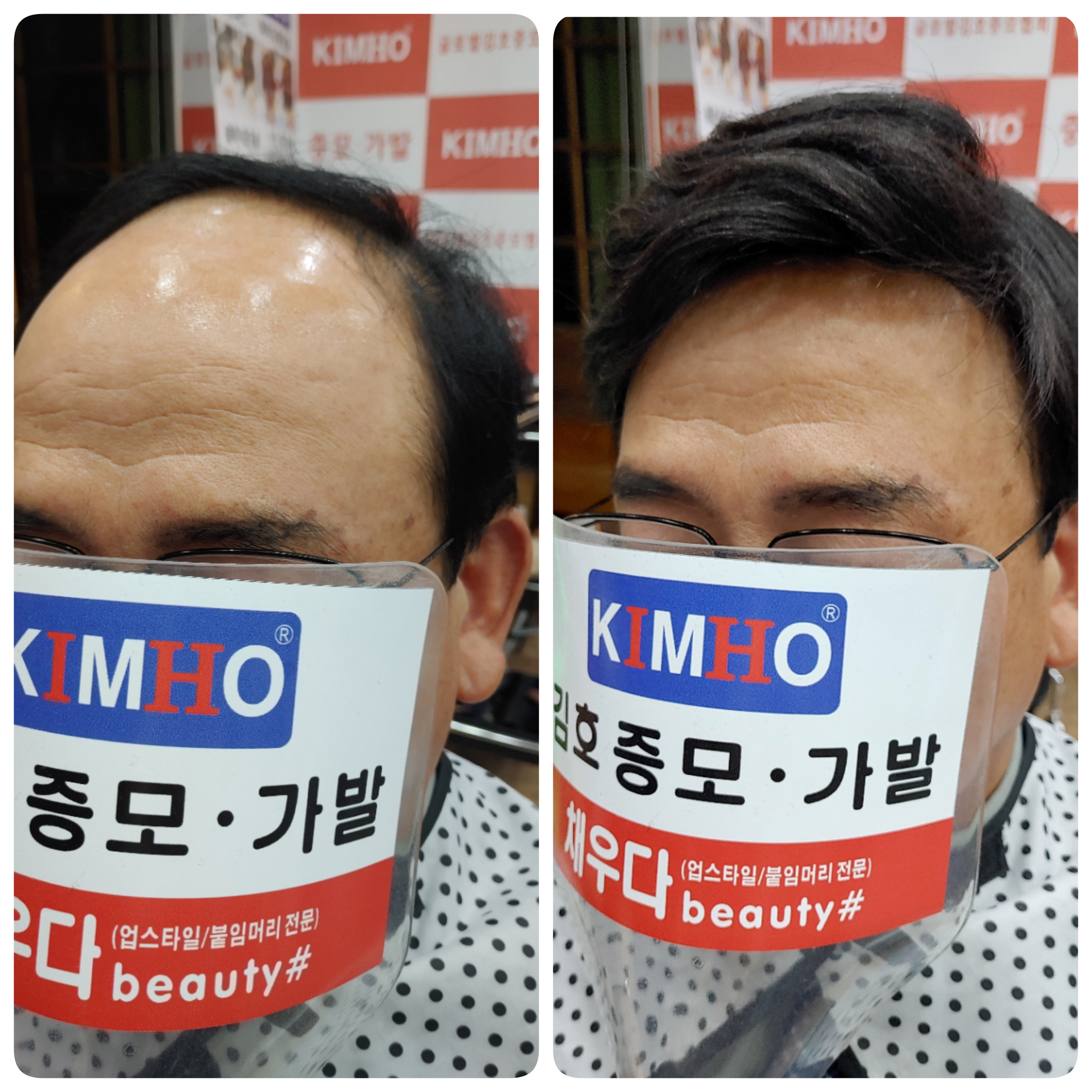 김호증모가발 채우다뷰티샵