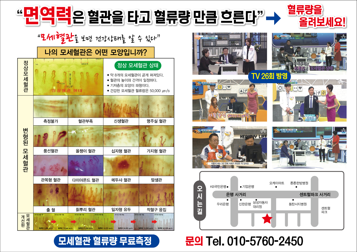 엔케이씨엘면역케어센터  동탄총판