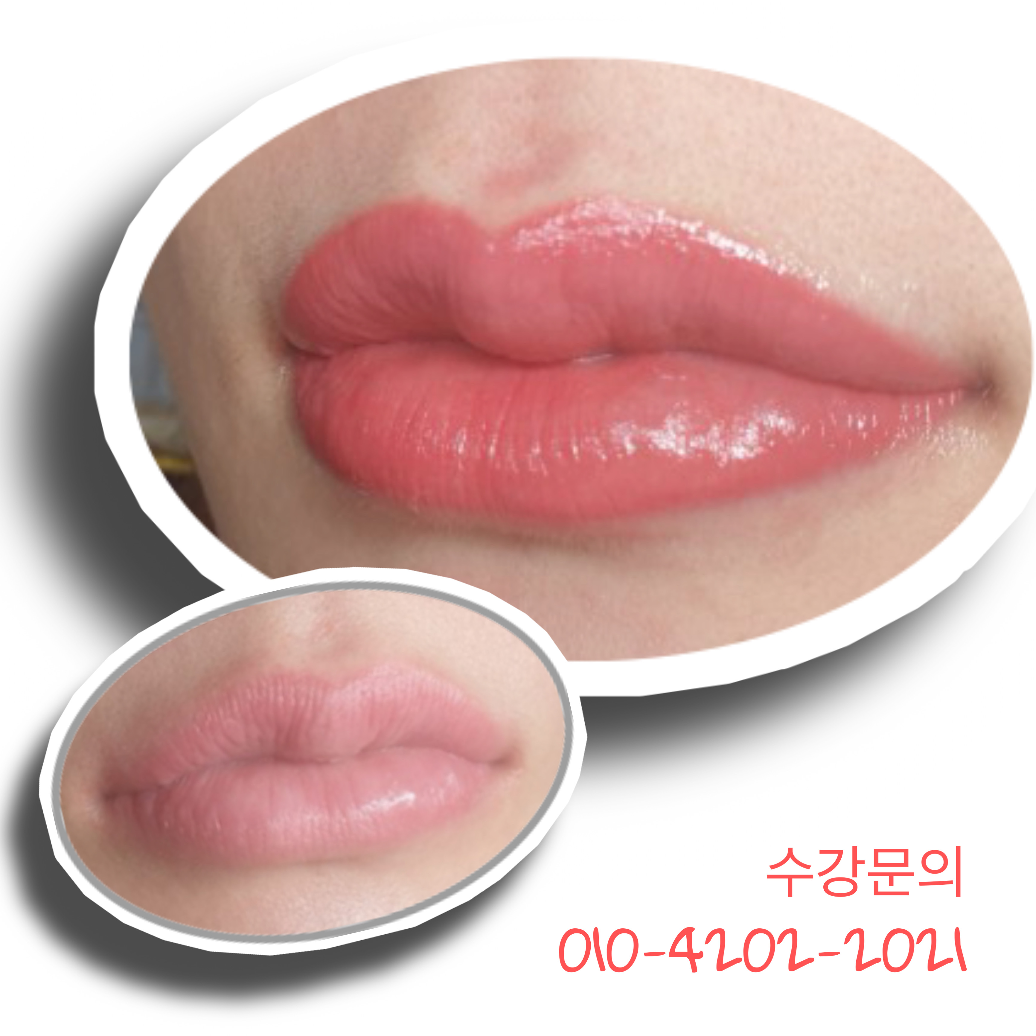루다뷰티