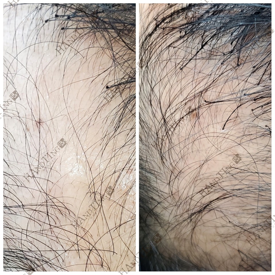 핸팅뷰티 본사 대표 이미지