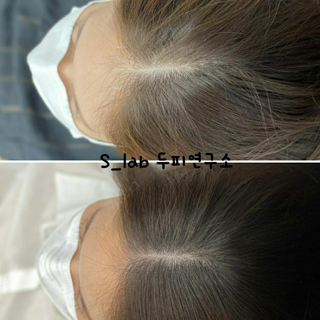 두피관리전문센터 에스랩 photo 9