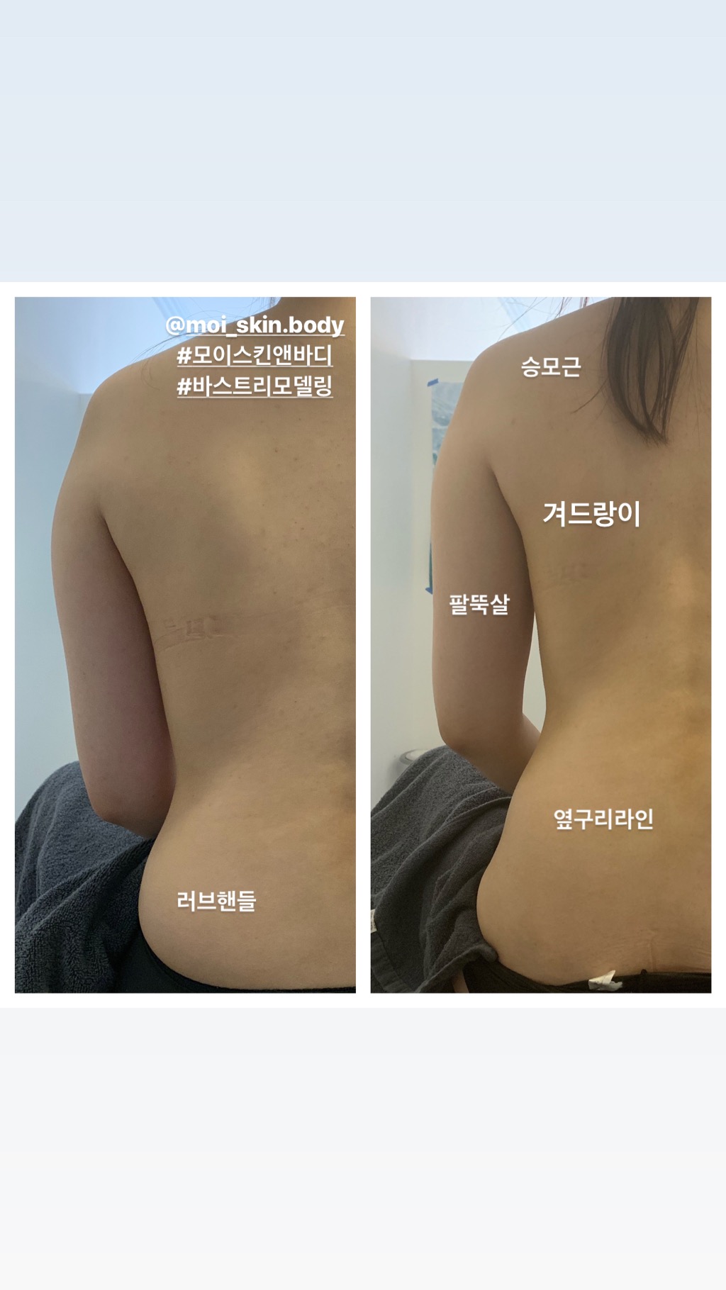모이스킨앤바디