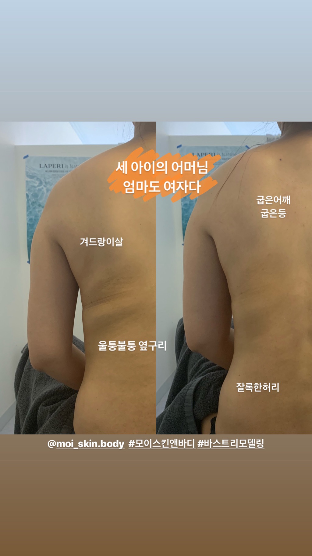 모이스킨앤바디