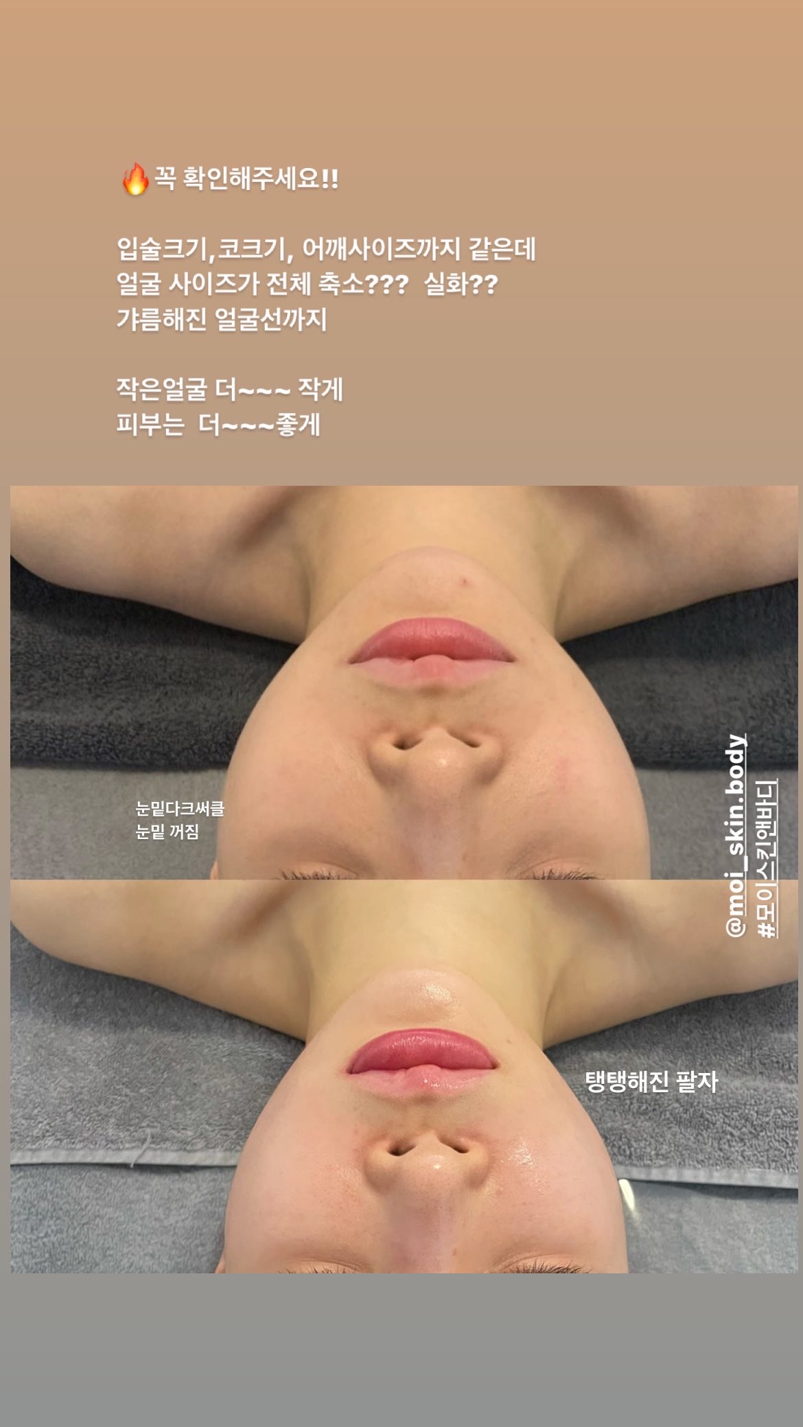모이스킨앤바디
