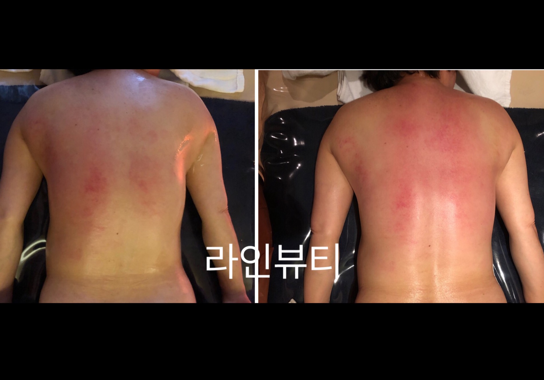 라인뷰티에스테틱