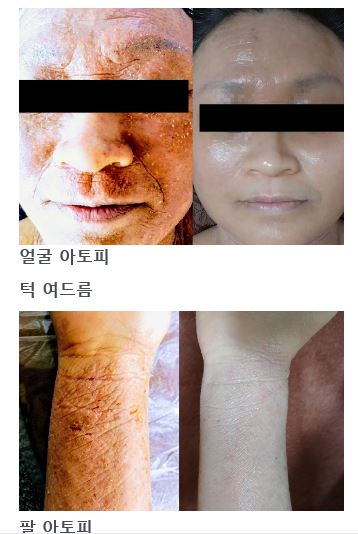 메르테라피 대표 이미지