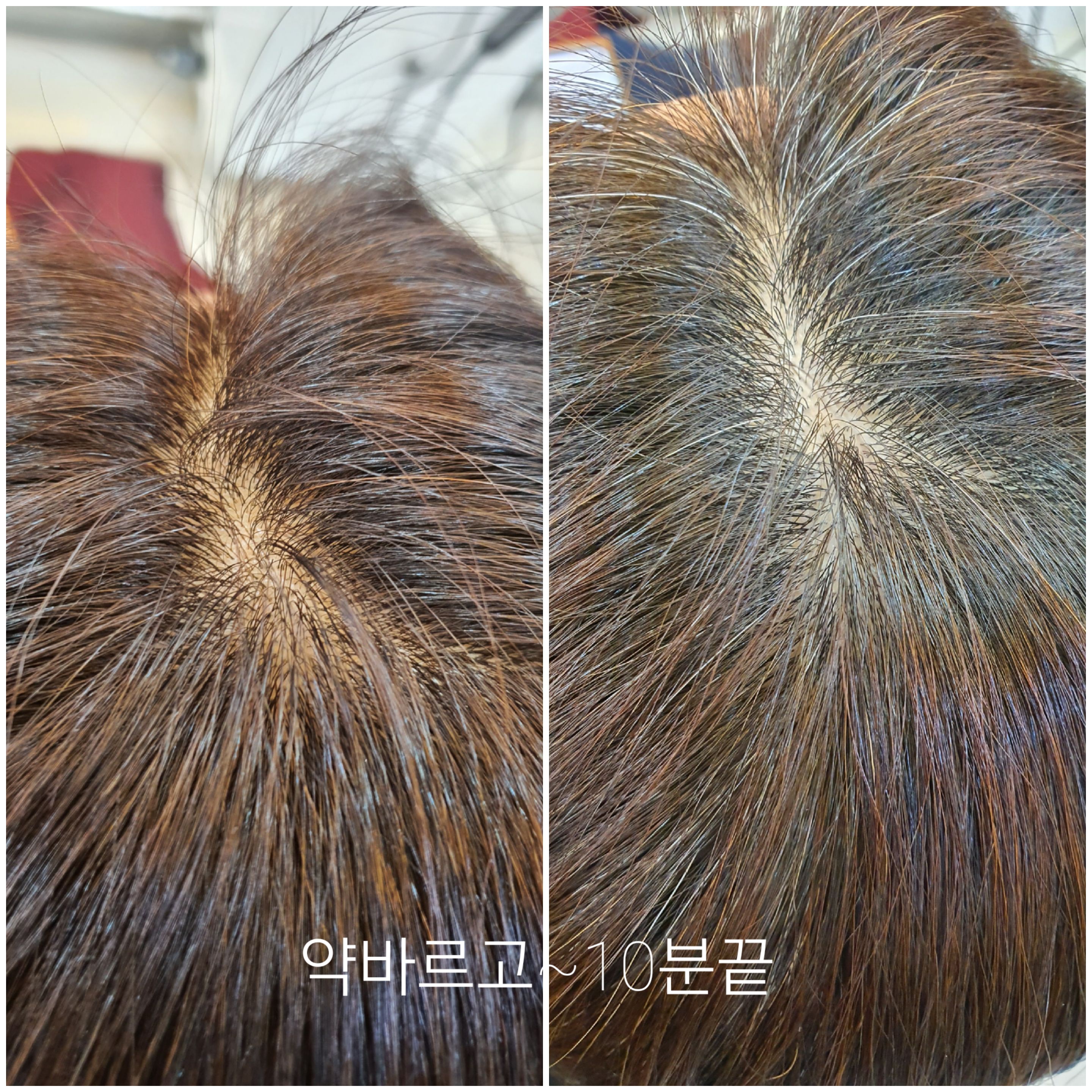 모완10헤어/모이든증모가발만덕점