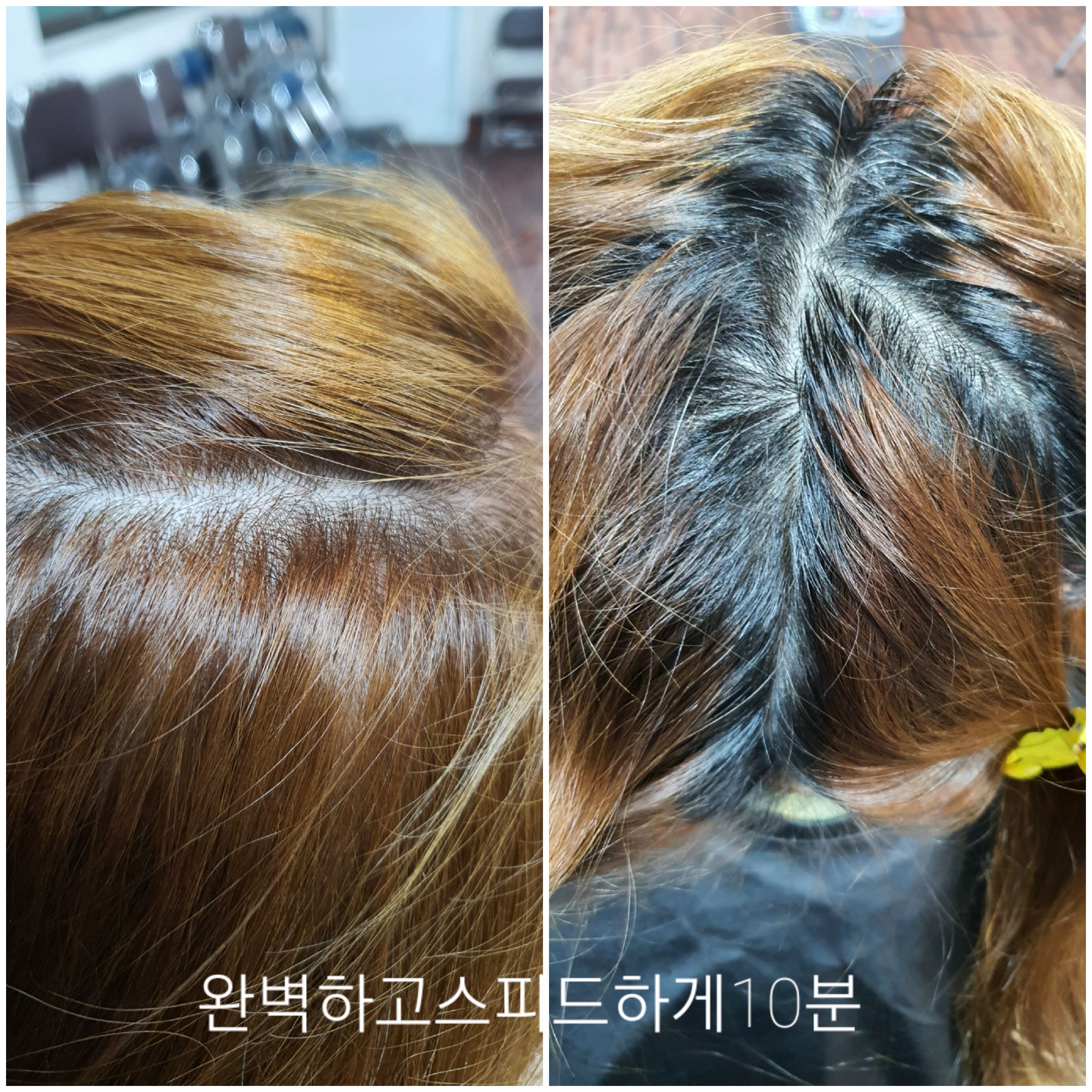 모완10헤어/모이든증모가발만덕점
