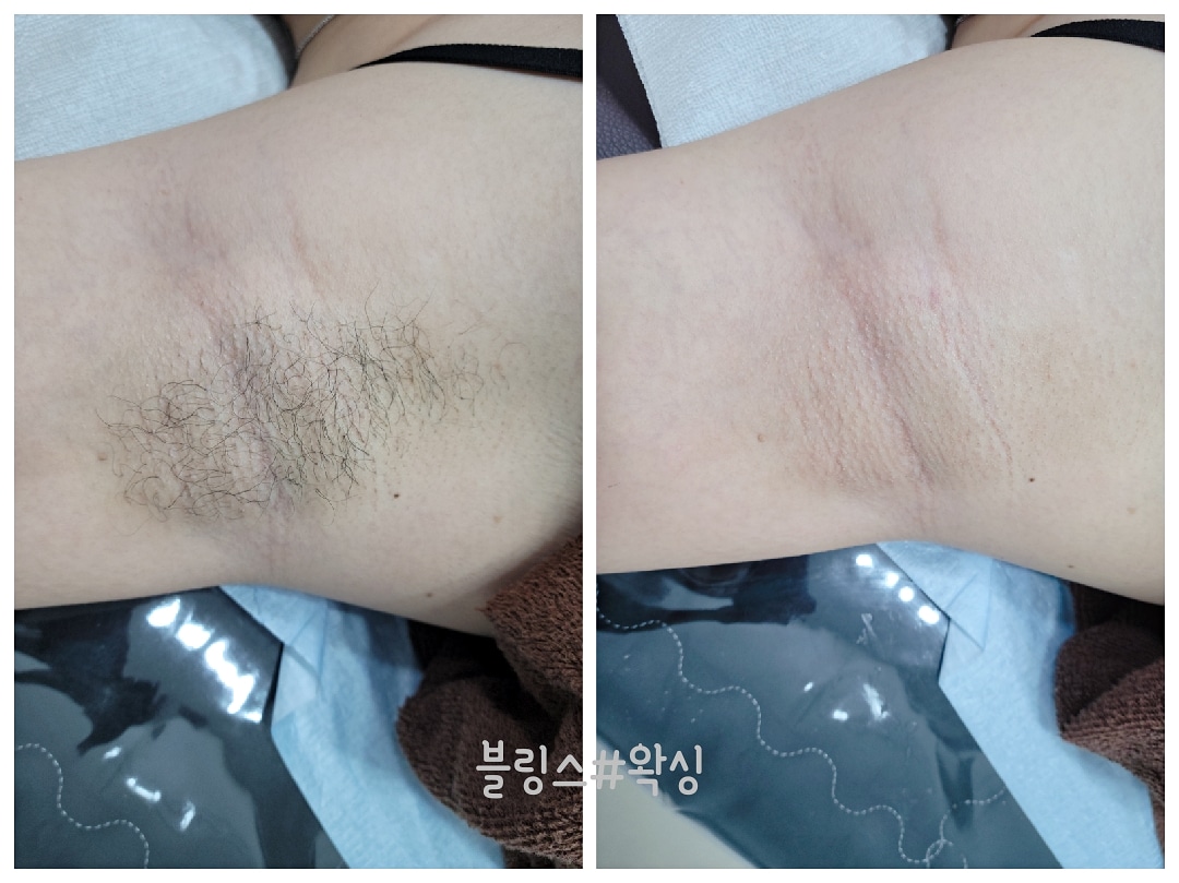 블링스왁싱 노원점