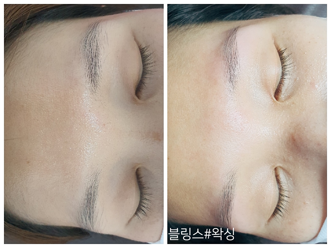 블링스왁싱 노원점