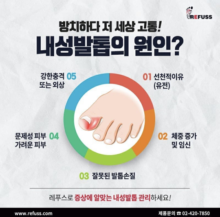 더네일 앤 레푸스진접점 대표 이미지