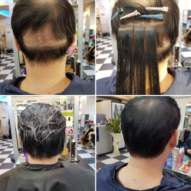 뷰티세럼 대표 이미지