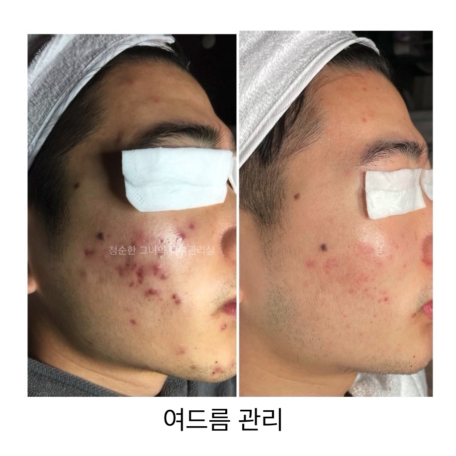 청순한 그녀의 피부관리실