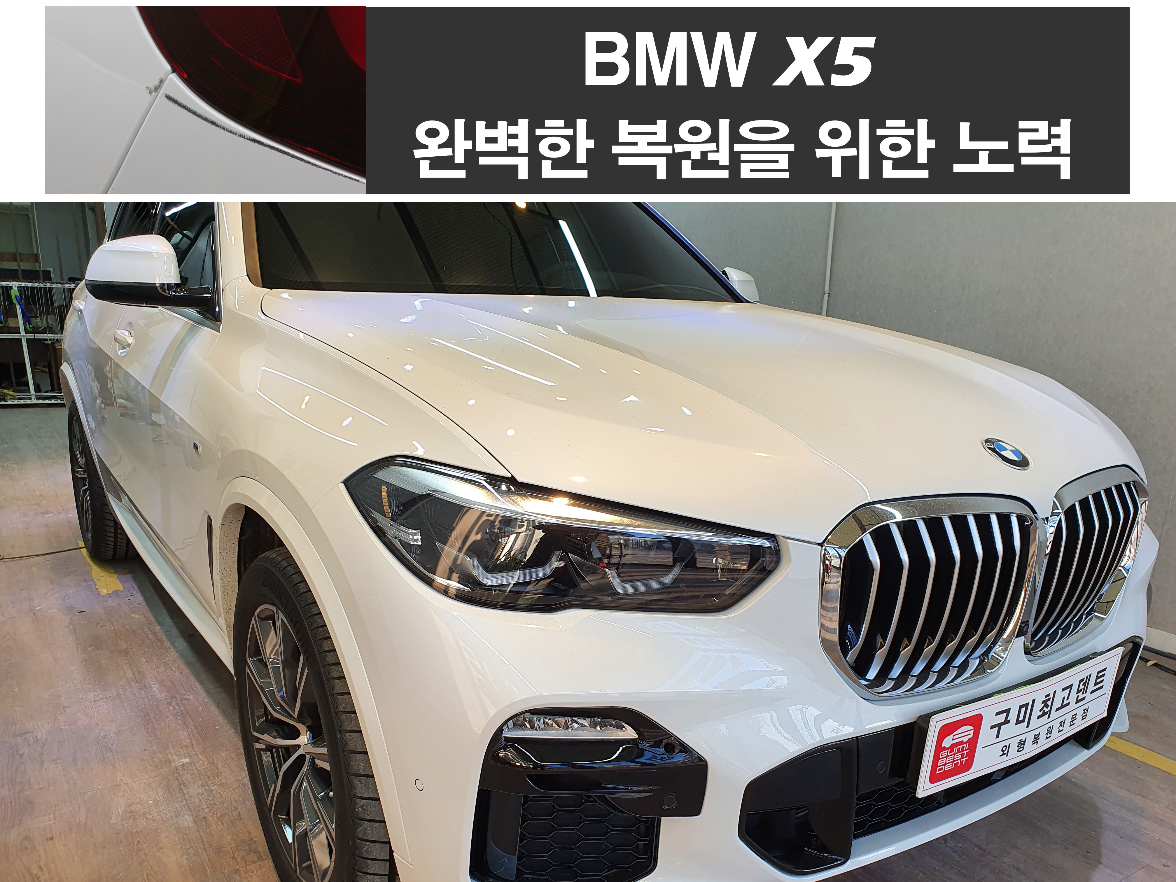 구미 최고 덴트집
