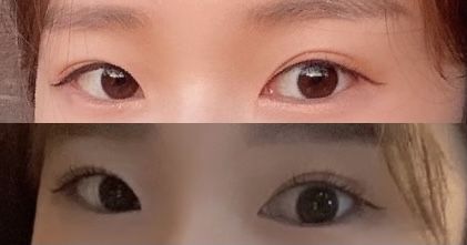 여우피부 photo 6